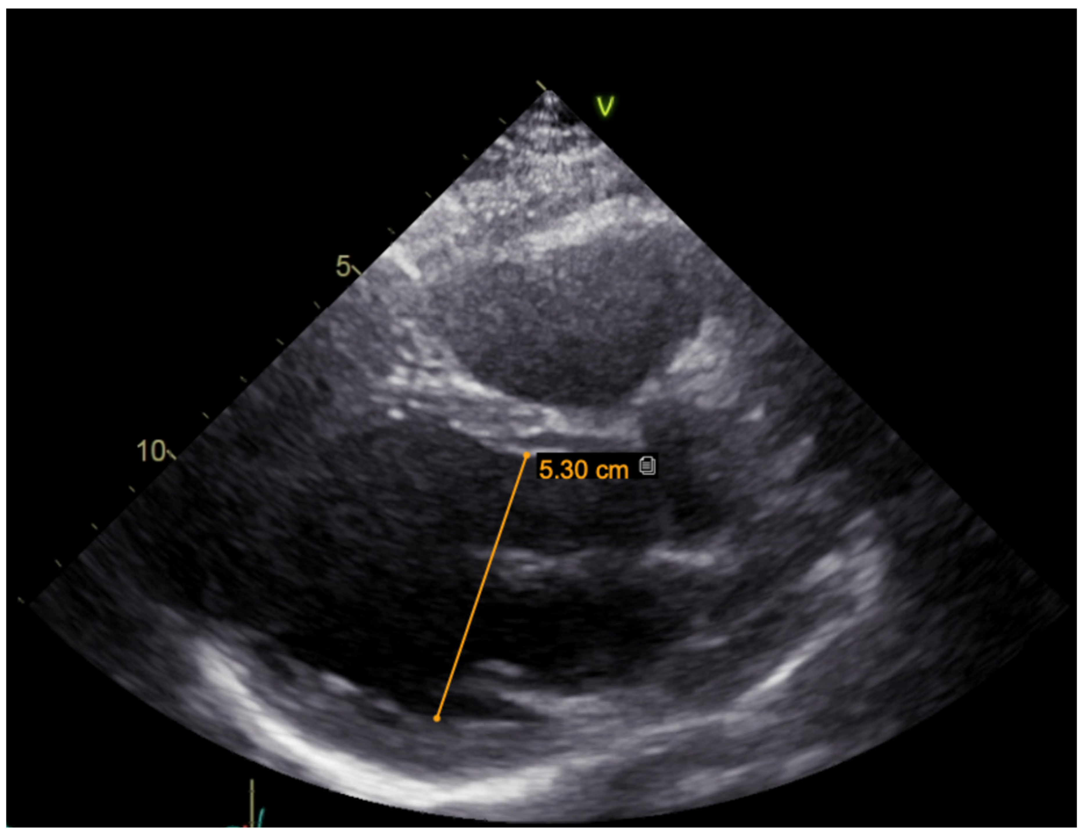 Medicina 61 00393 g005