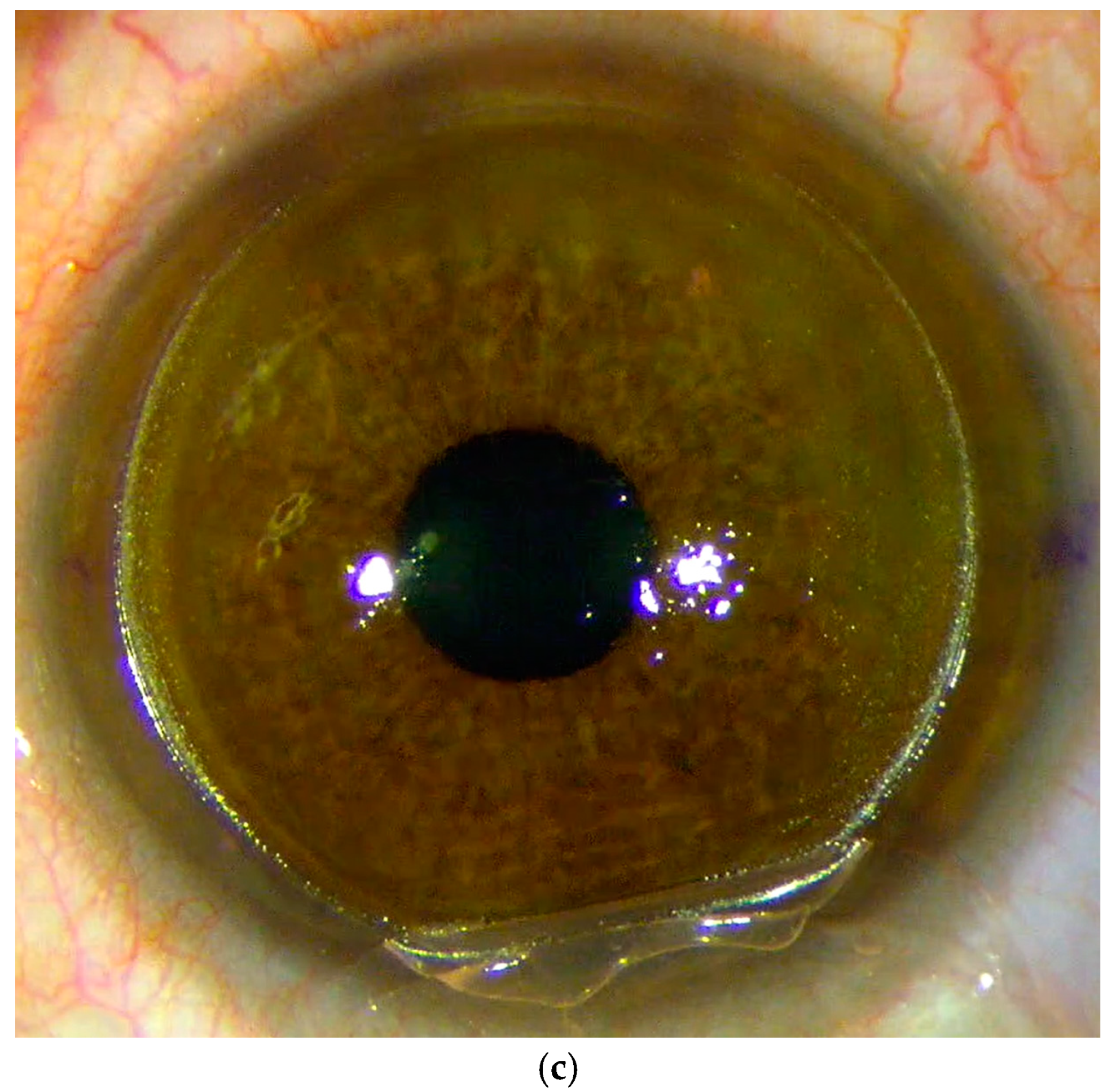 Medicina 61 00395 g001b