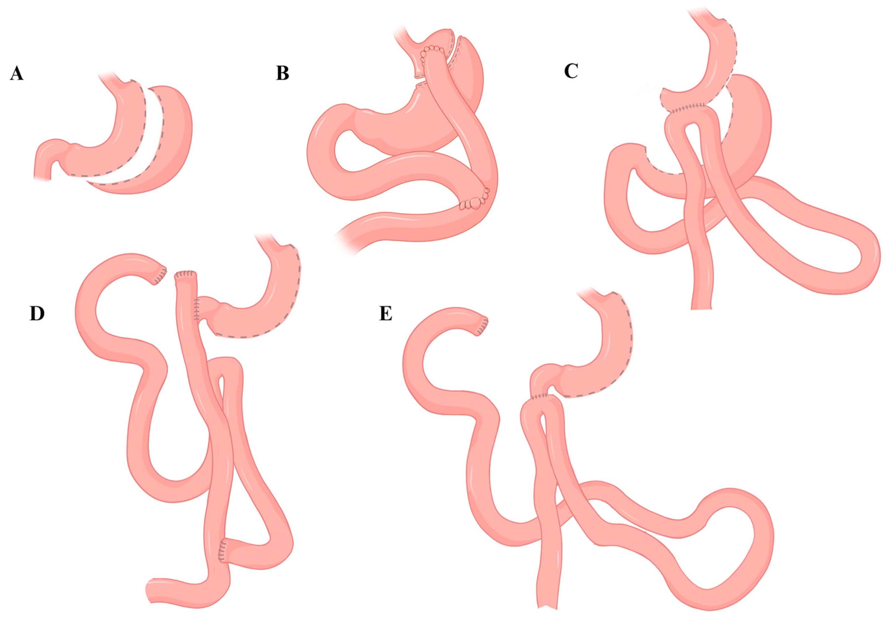 Medicina 61 00398 g003