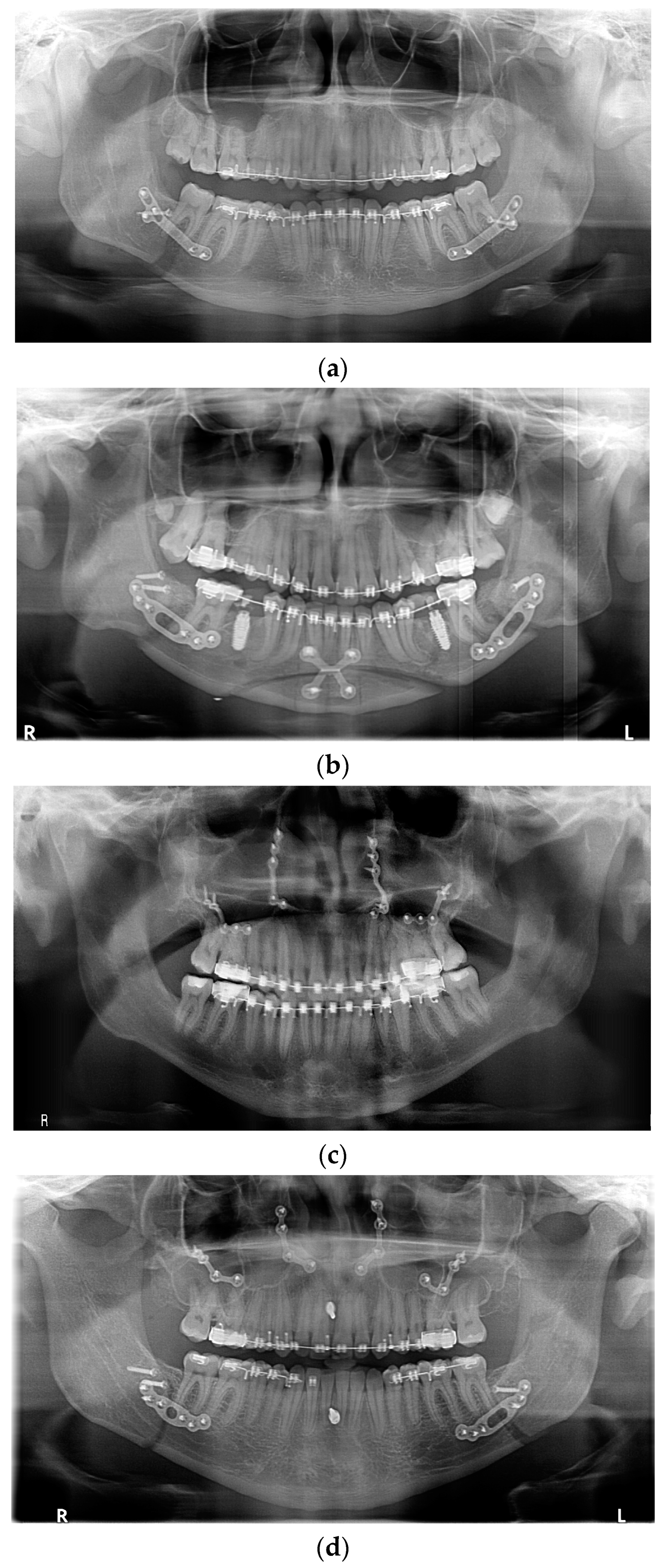 Medicina 61 00403 g001a