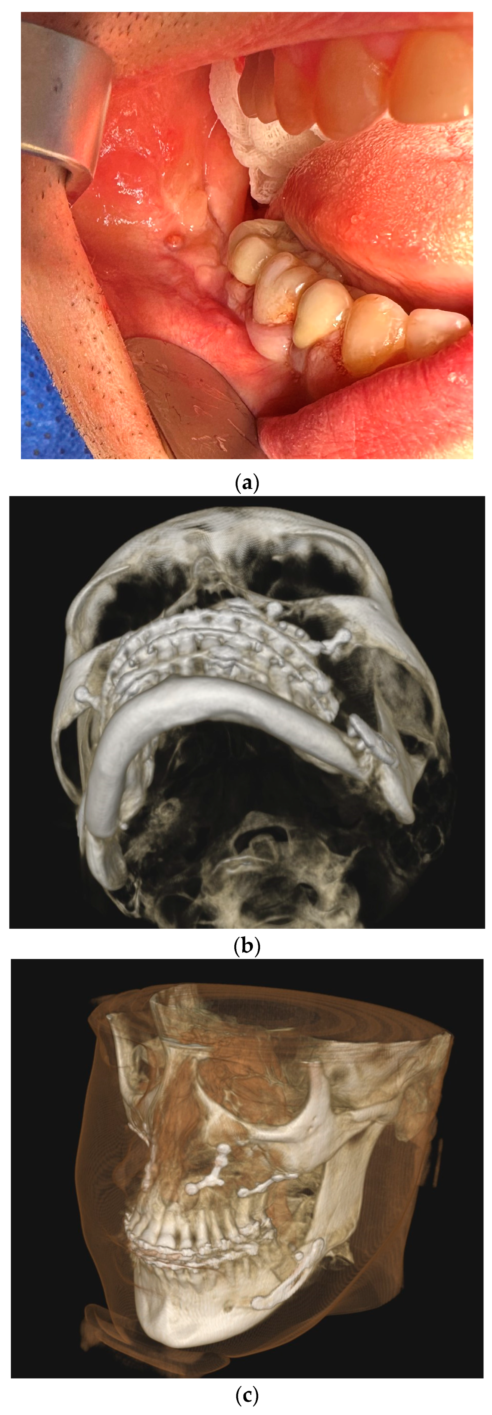 Medicina 61 00403 g002