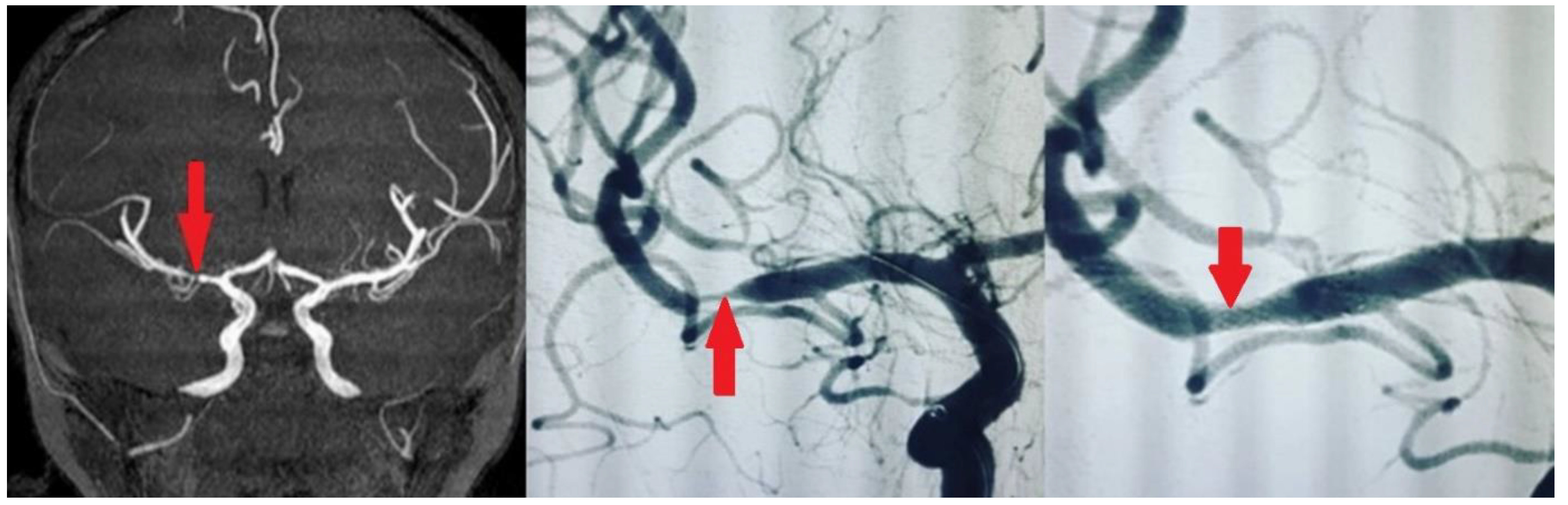Medicina 61 00404 g002
