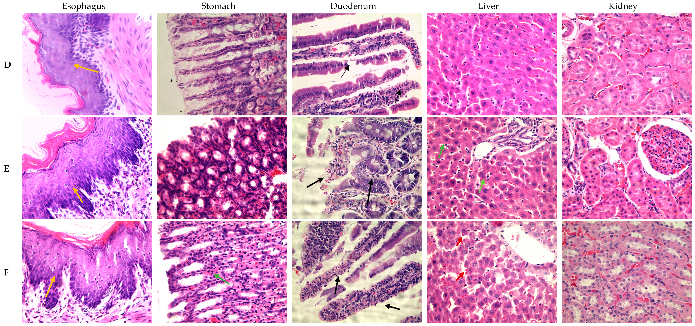 Medicina 61 00429 g003b
