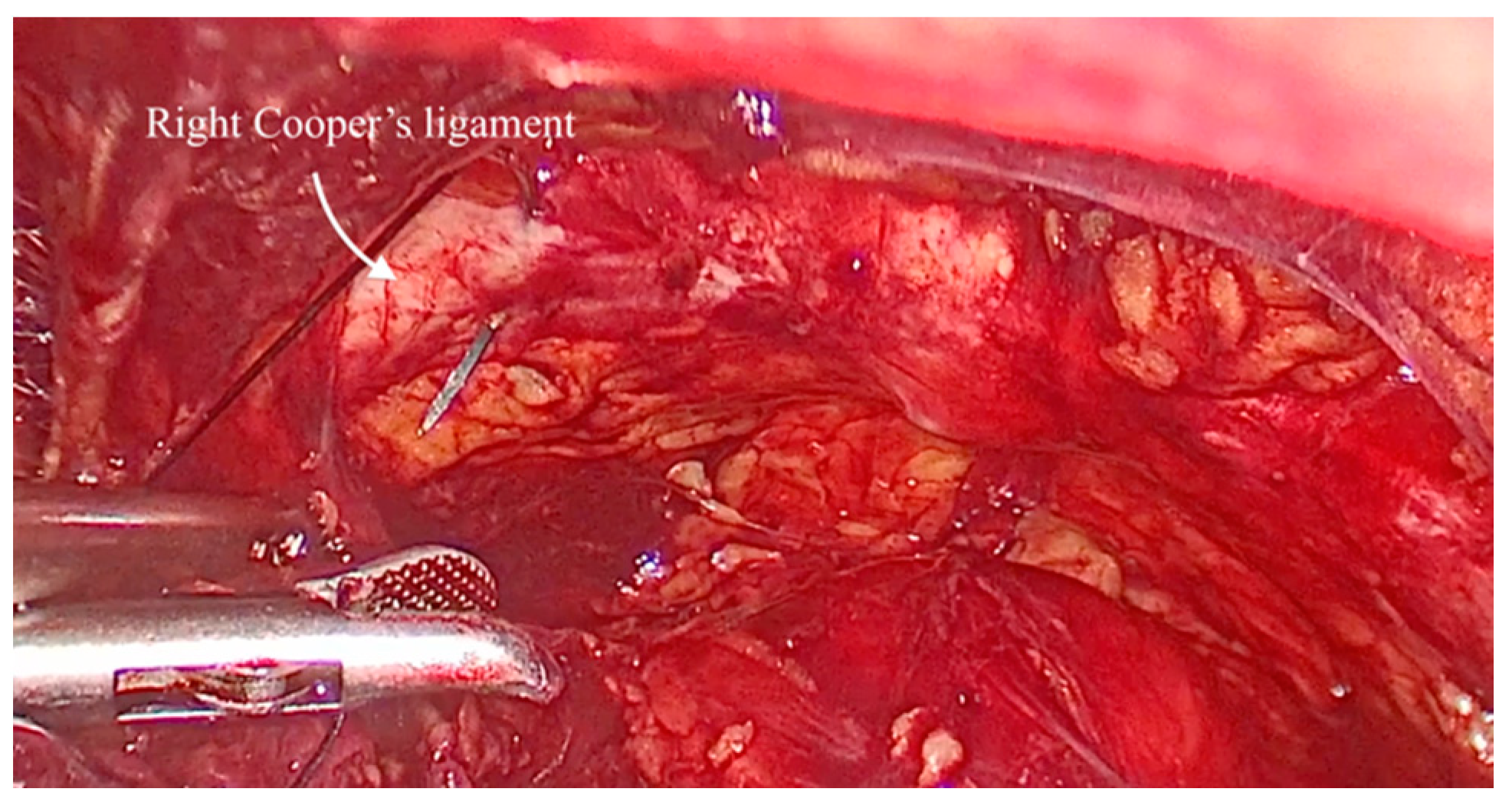 Medicina 61 00436 g002