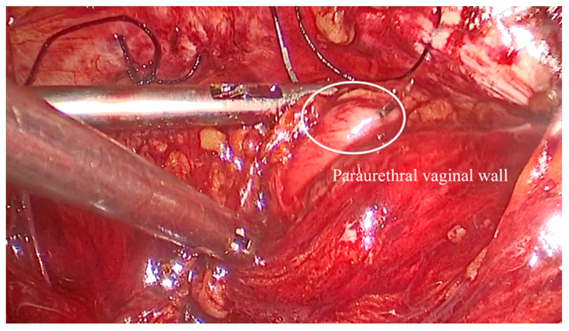 Medicina 61 00436 g003