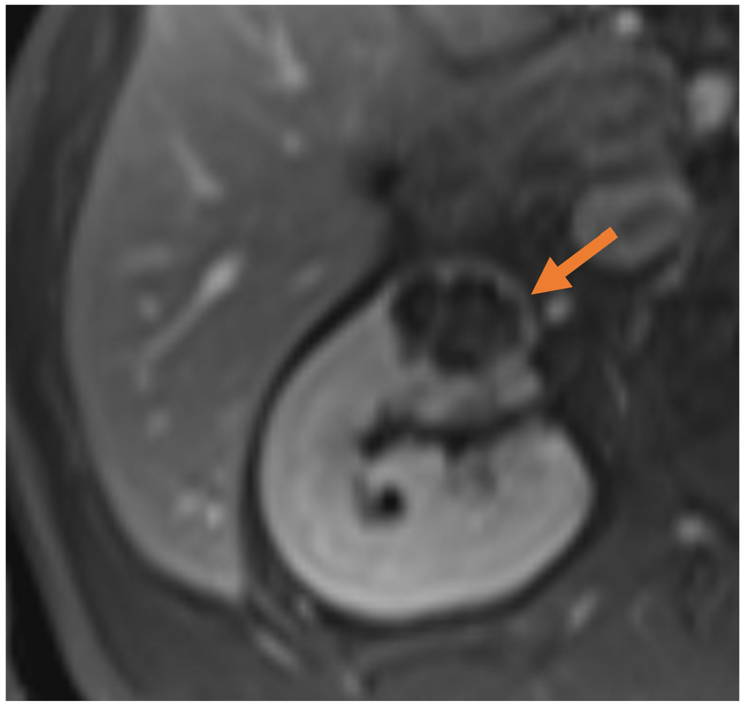 Medicina 61 00438 g001