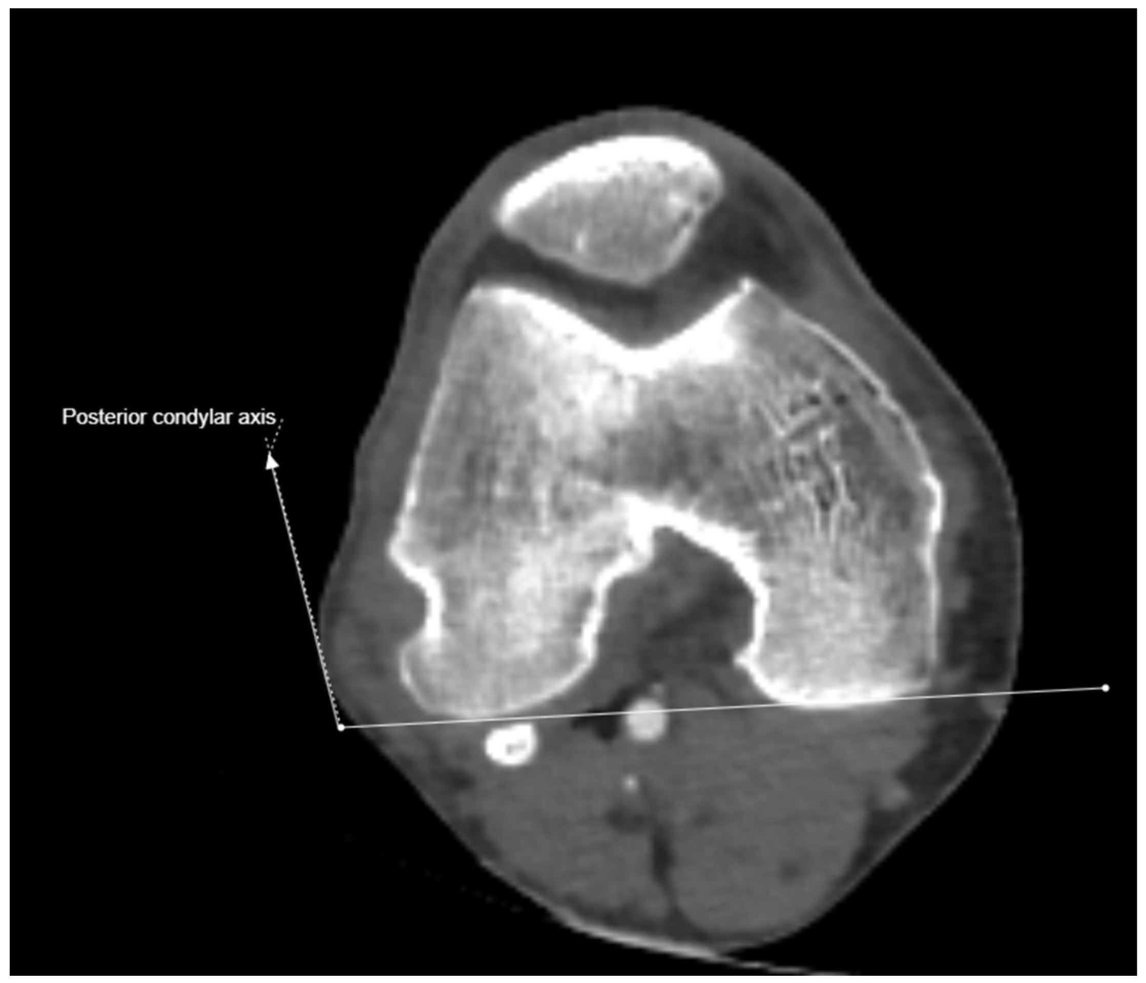 Medicina 61 00441 g001