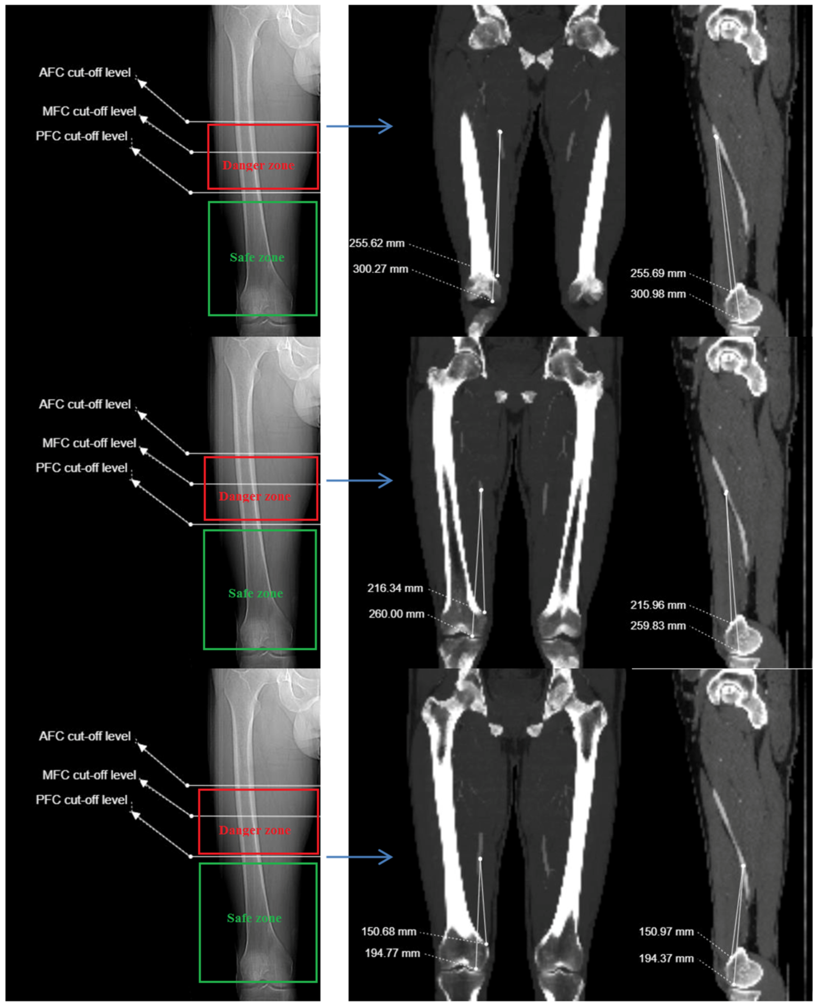 Medicina 61 00441 g004