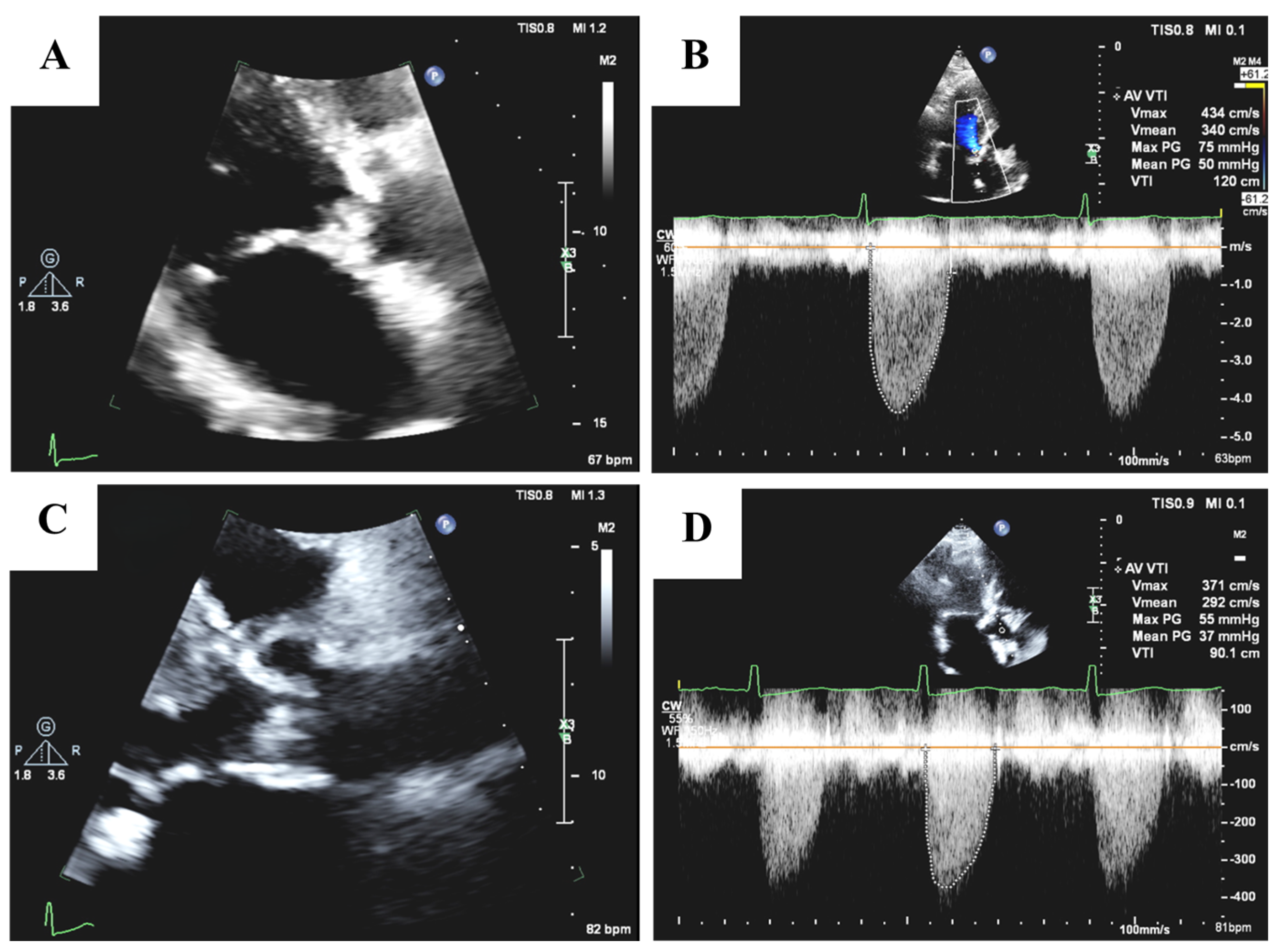 Medicina 61 00448 g002 Medicina 61 00448 g002
