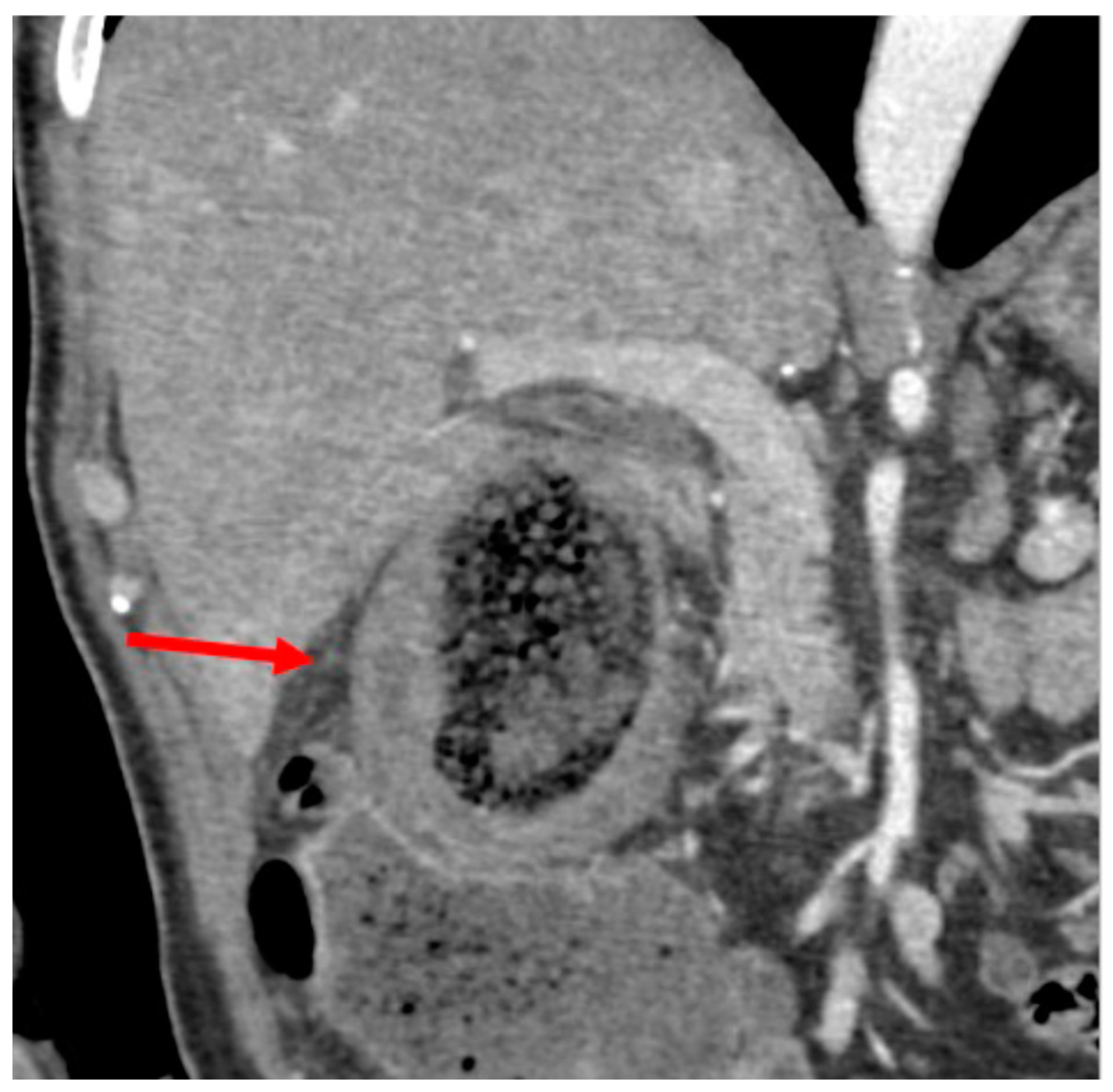 Medicina 61 00452 g001