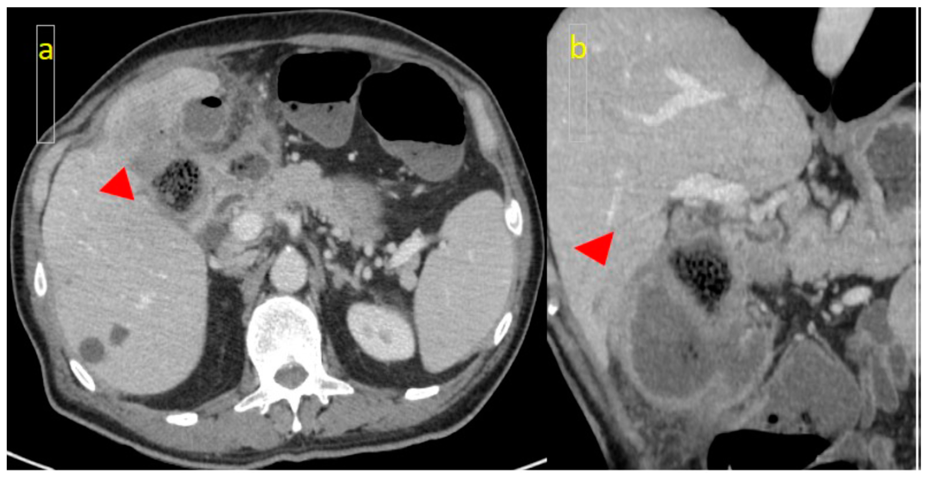 Medicina 61 00452 g003