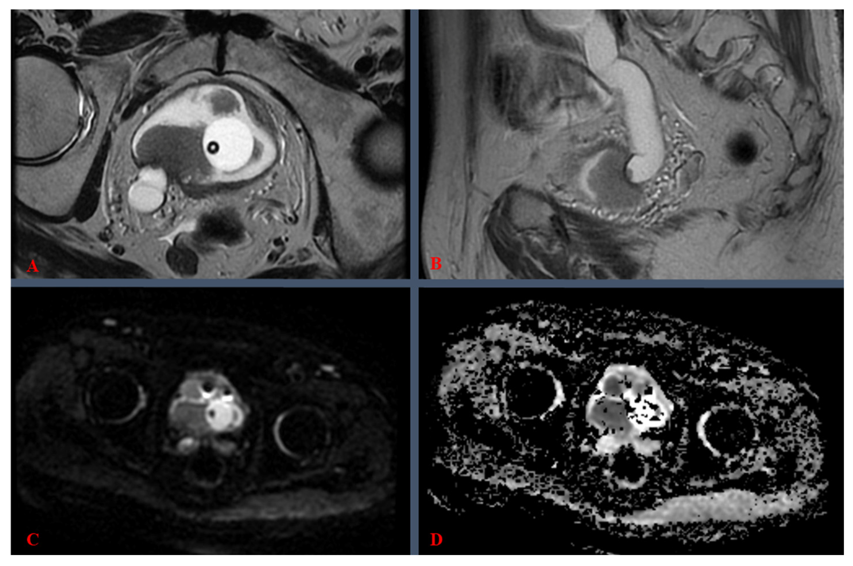 Medicina 61 00469 g003