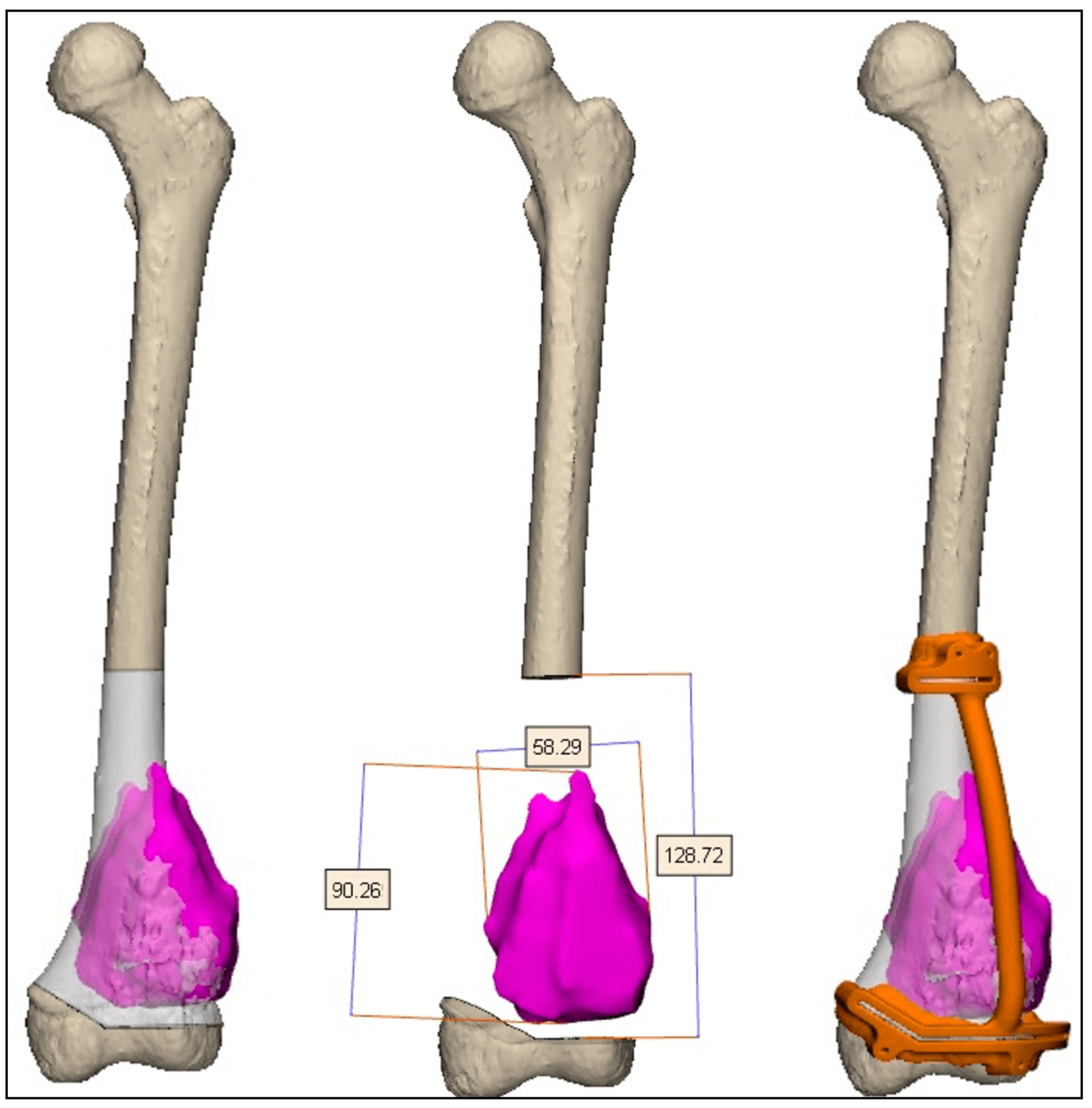 Medicina 61 00476 g002