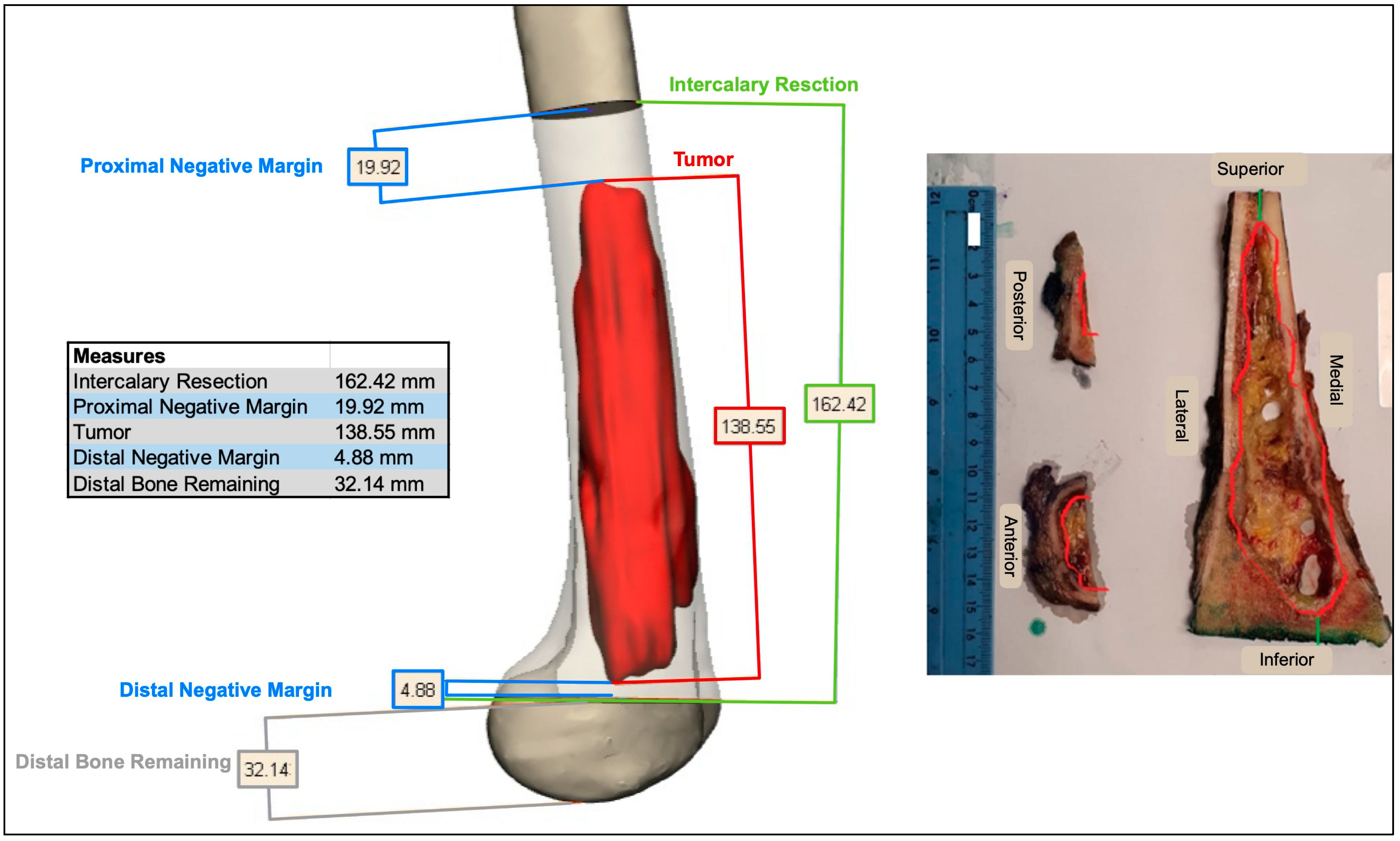 Medicina 61 00476 g003