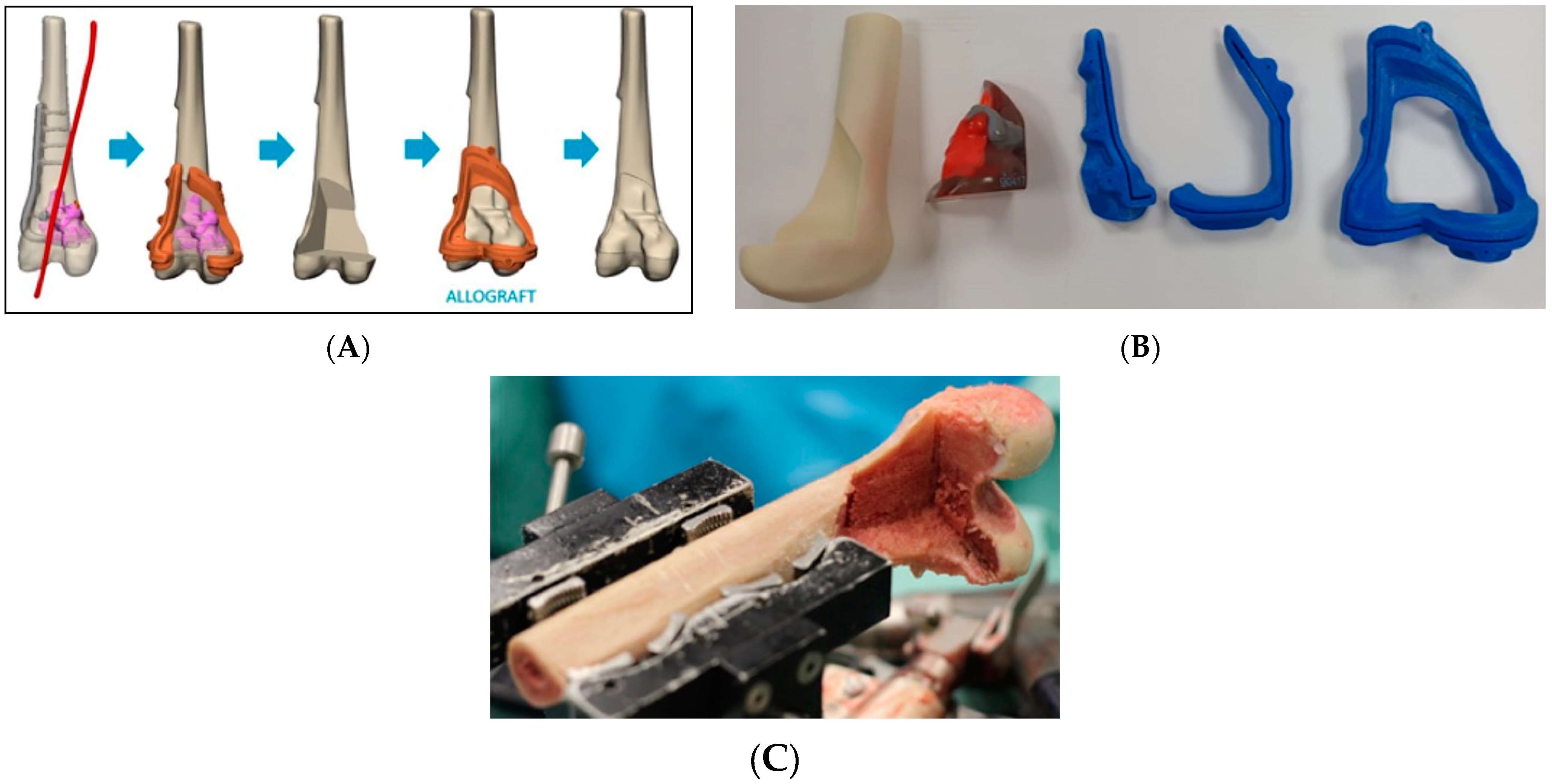 Medicina 61 00476 g004