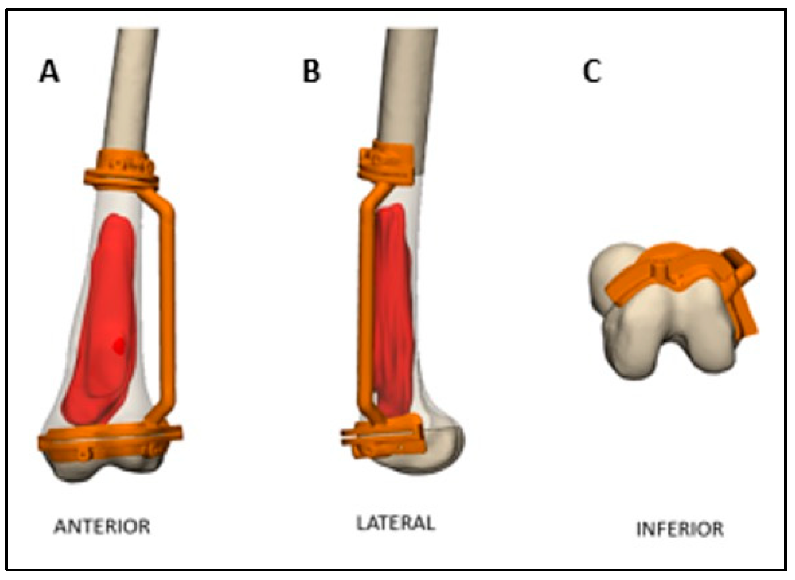 Medicina 61 00476 g005