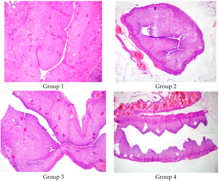 Medicina 61 00482 g002