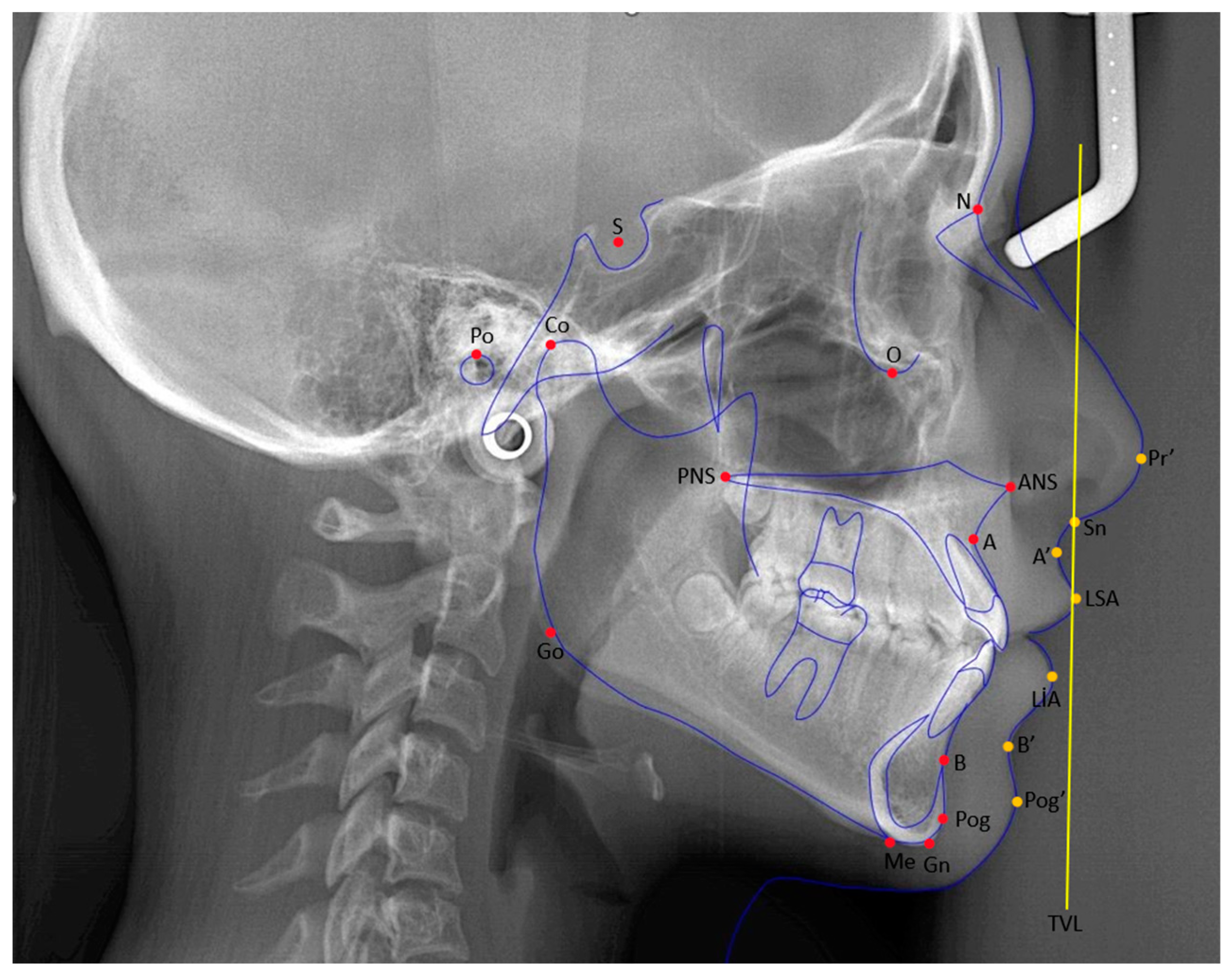 Medicina 61 00485 g001 Medicina 61 00485 g001