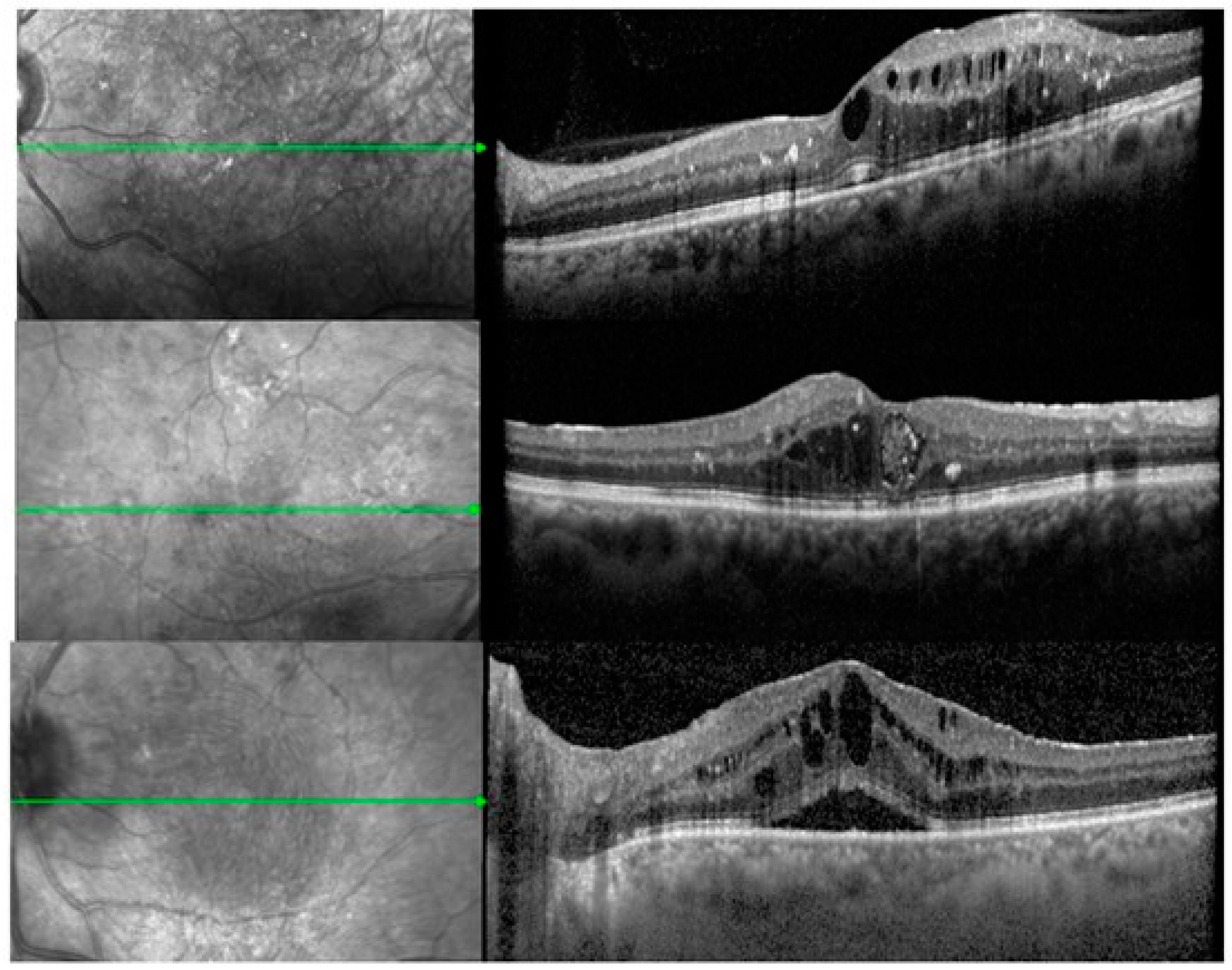 Medicina 61 00488 g001