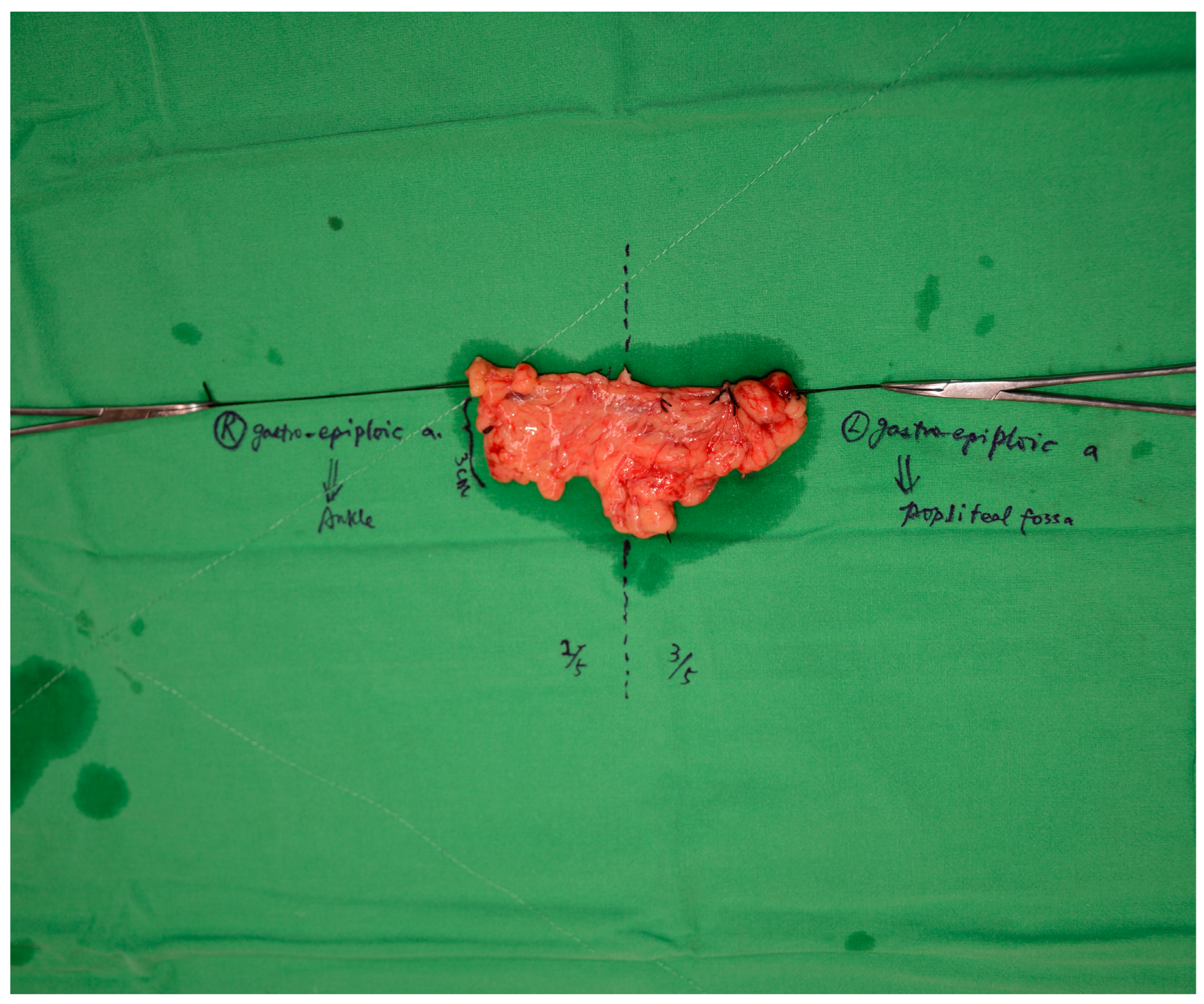 Medicina 61 00503 g002