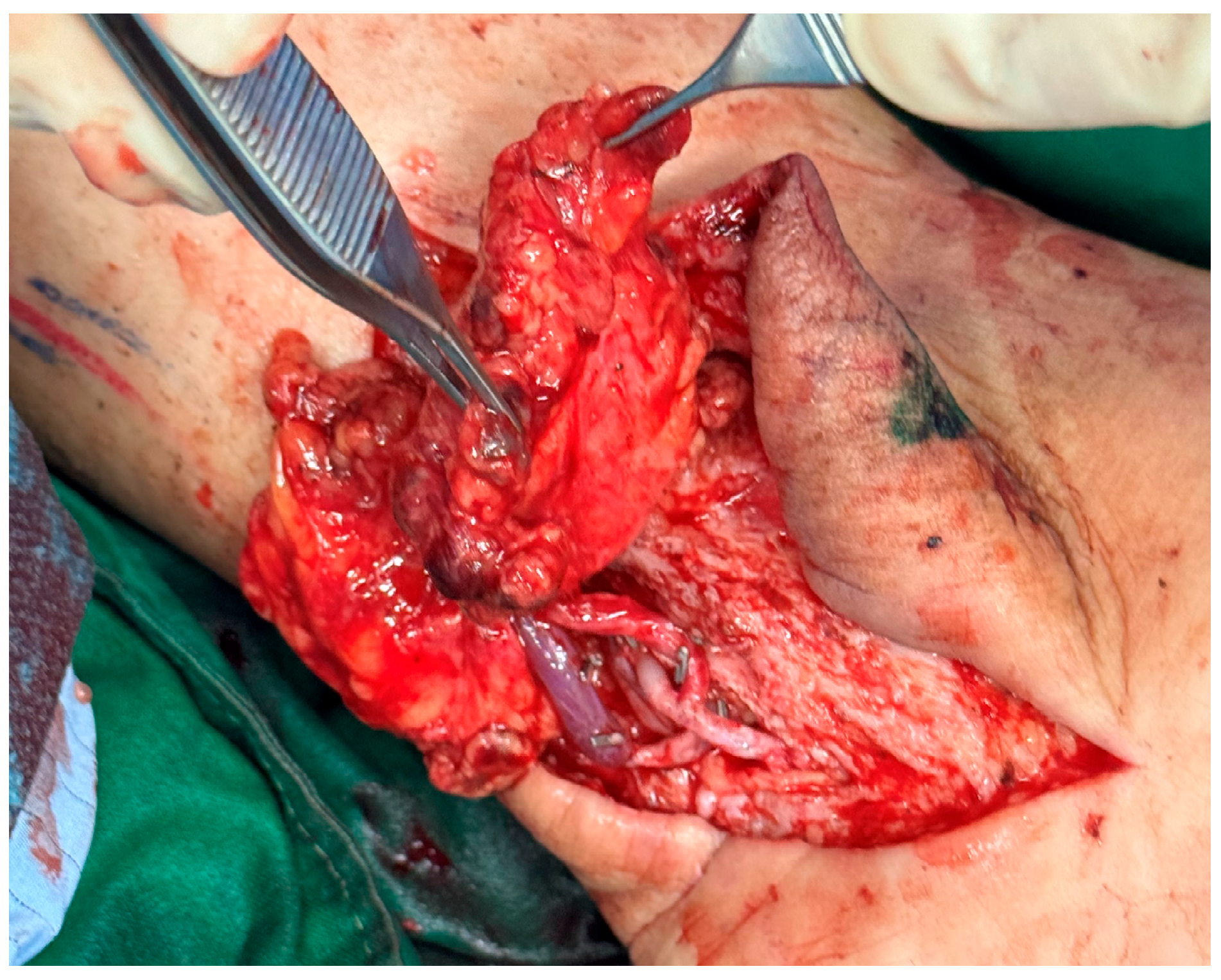 Medicina 61 00503 g004