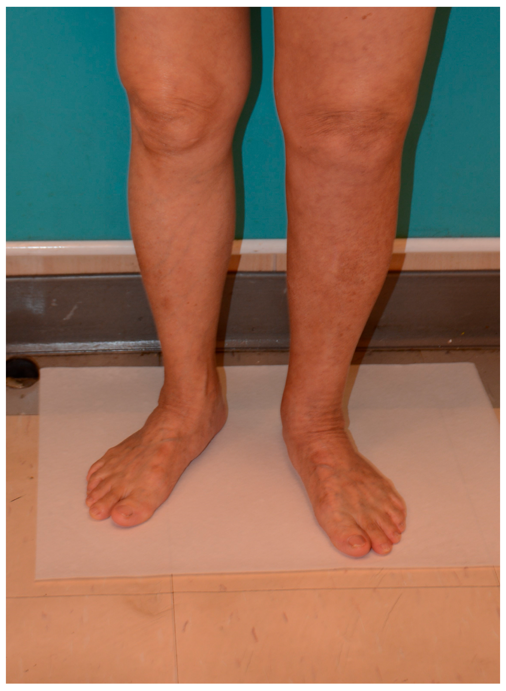 Medicina 61 00503 g006