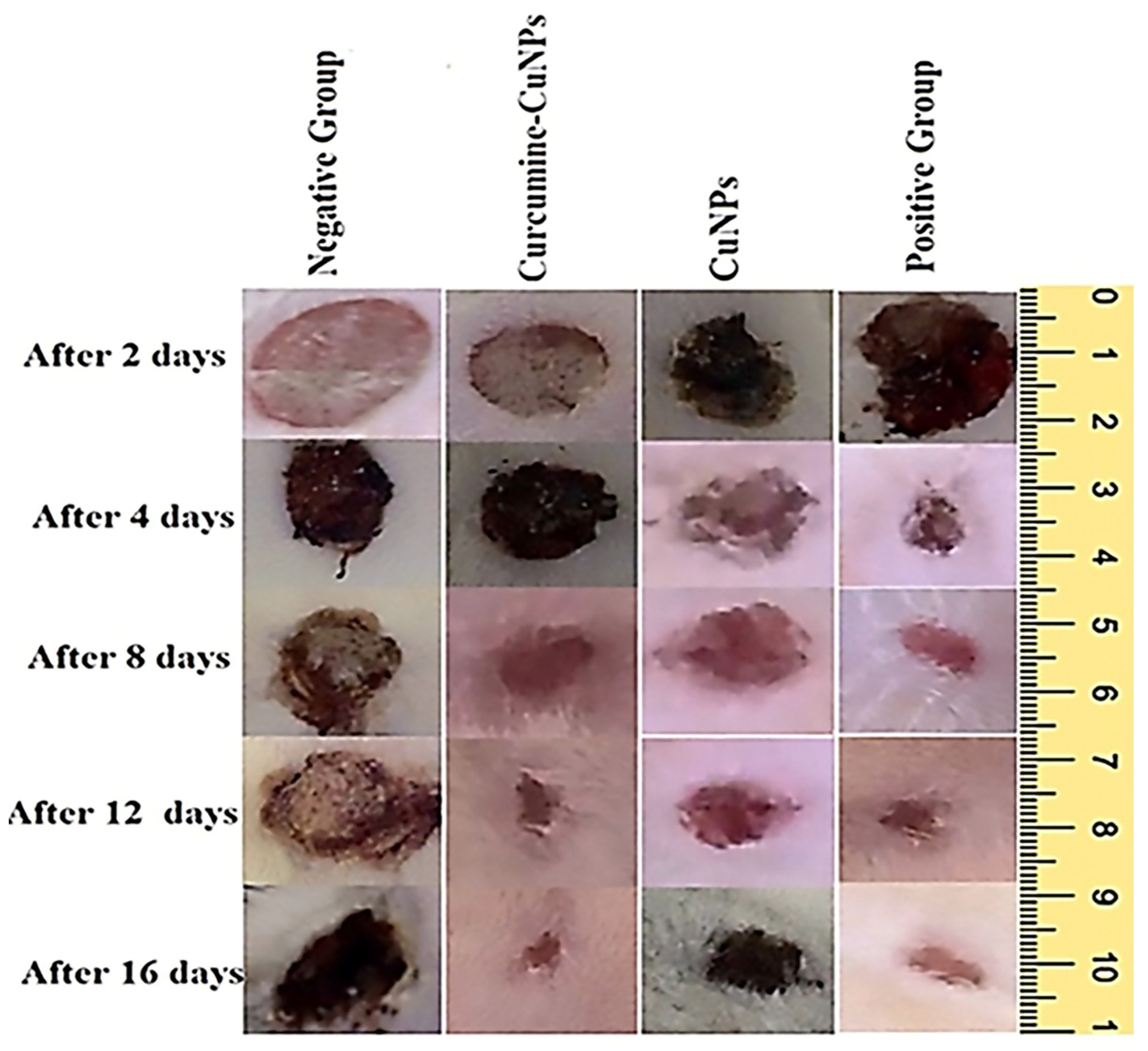 Medicina 61 00515 g004