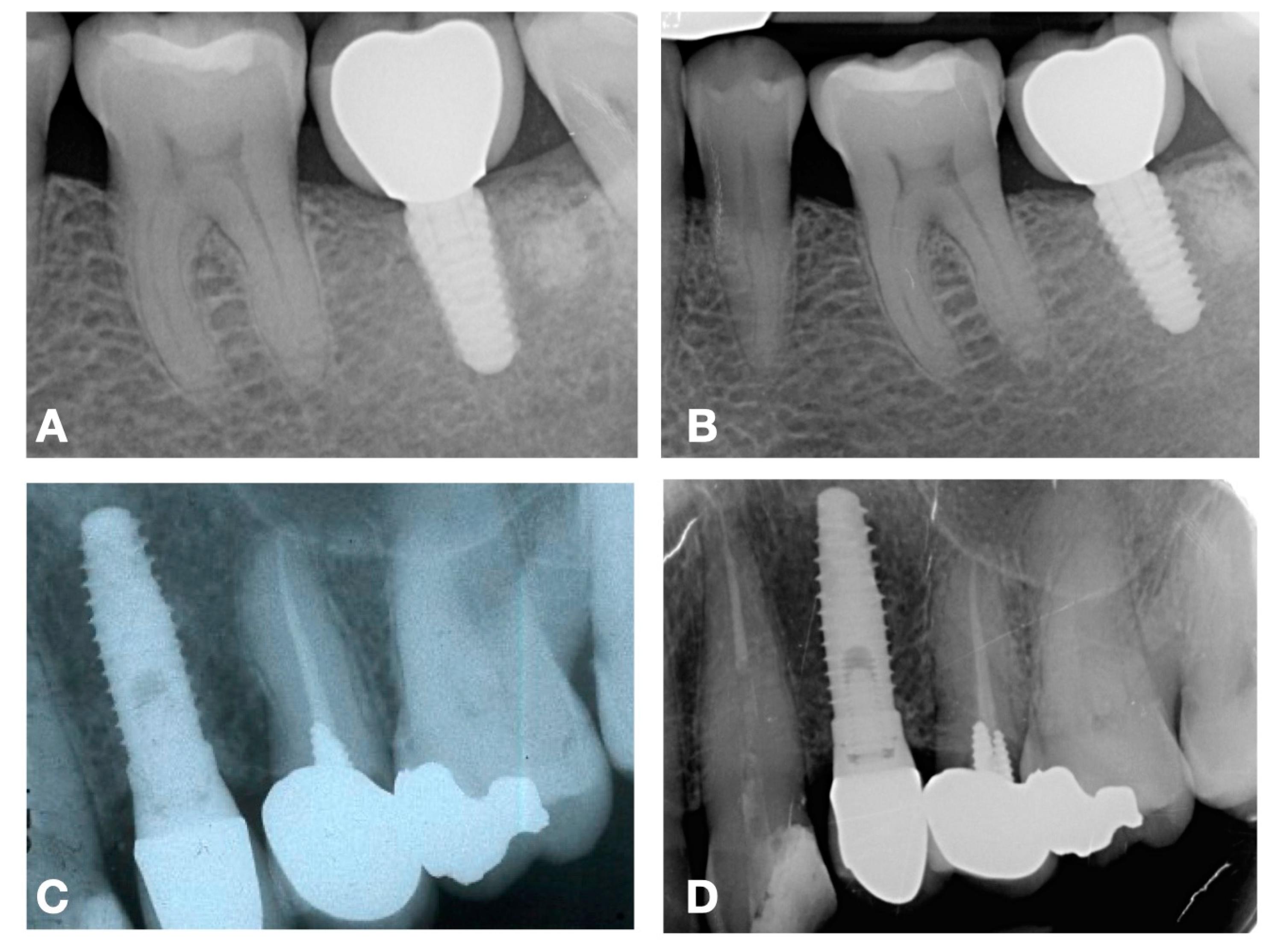 Medicina 61 00517 g002