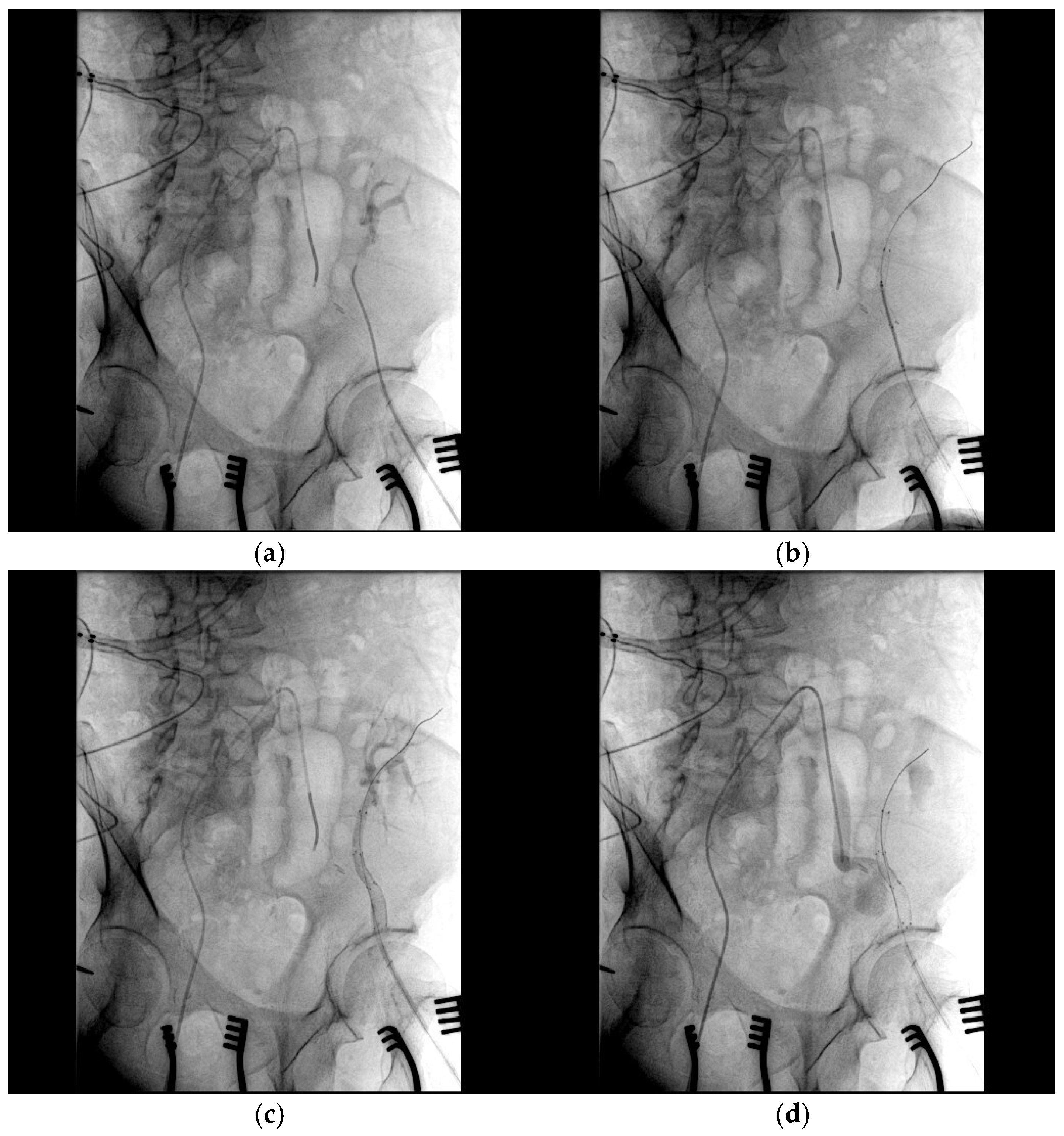 Medicina 61 00521 g004
