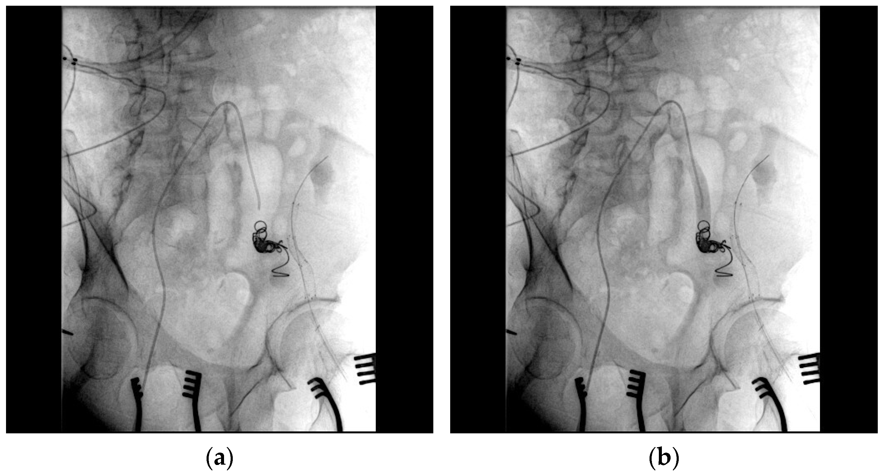 Medicina 61 00521 g005