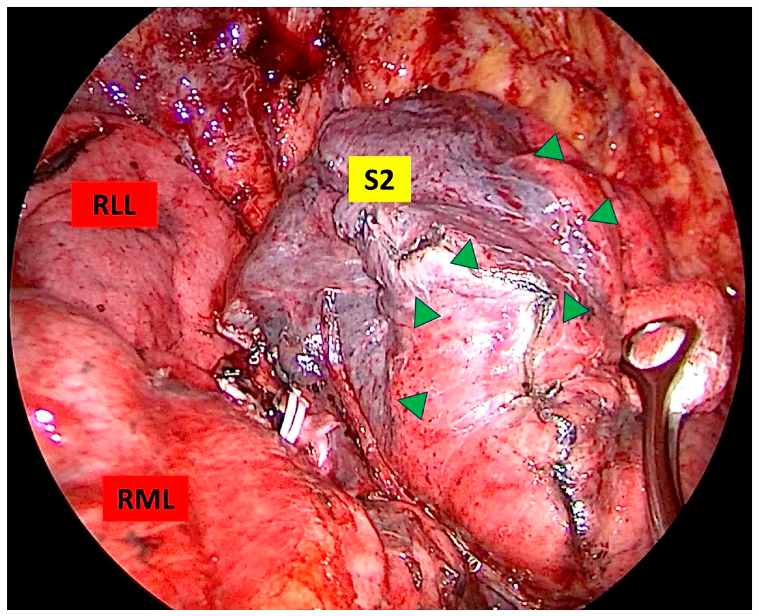Medicina 61 00535 g003