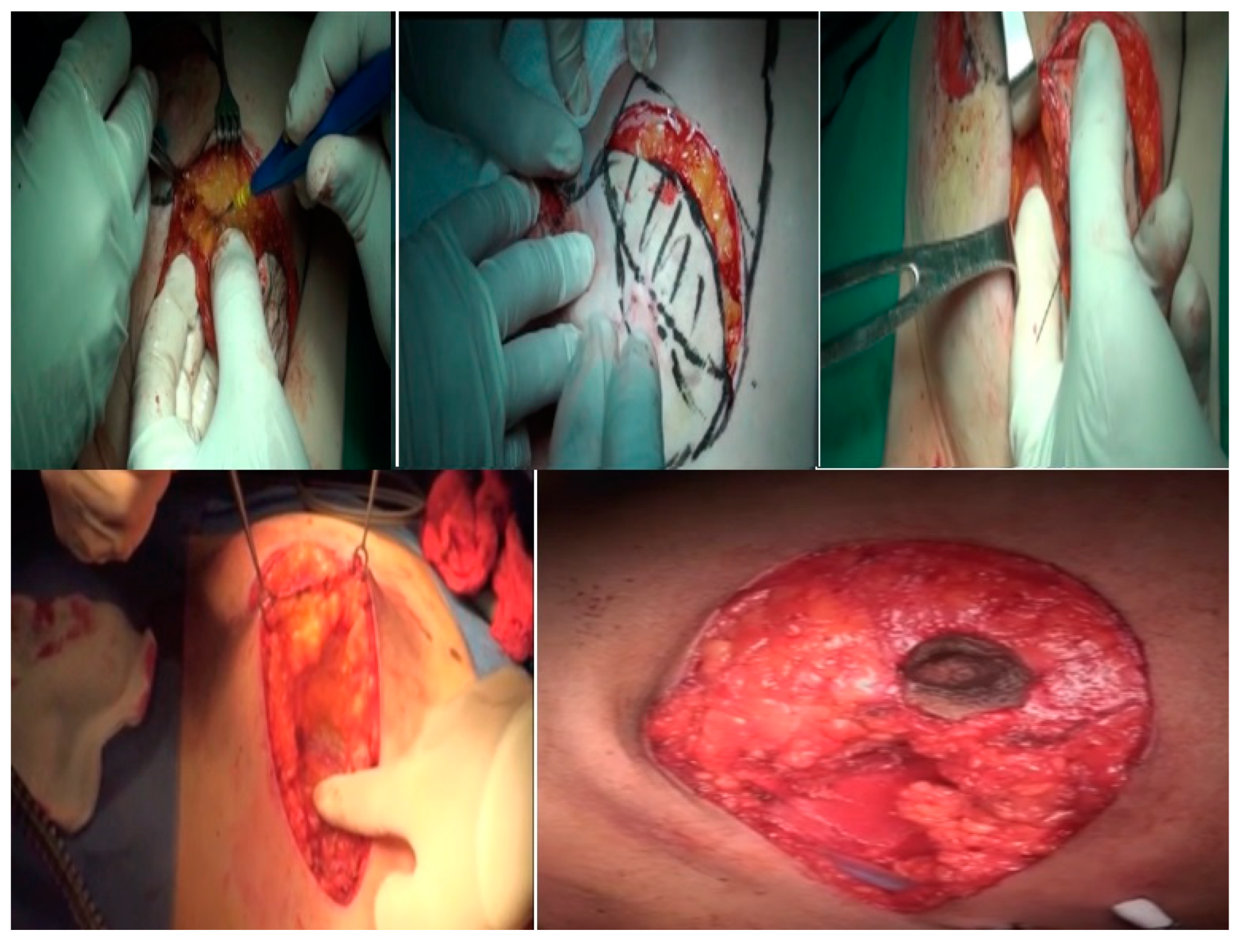 Medicina 61 00539 g002