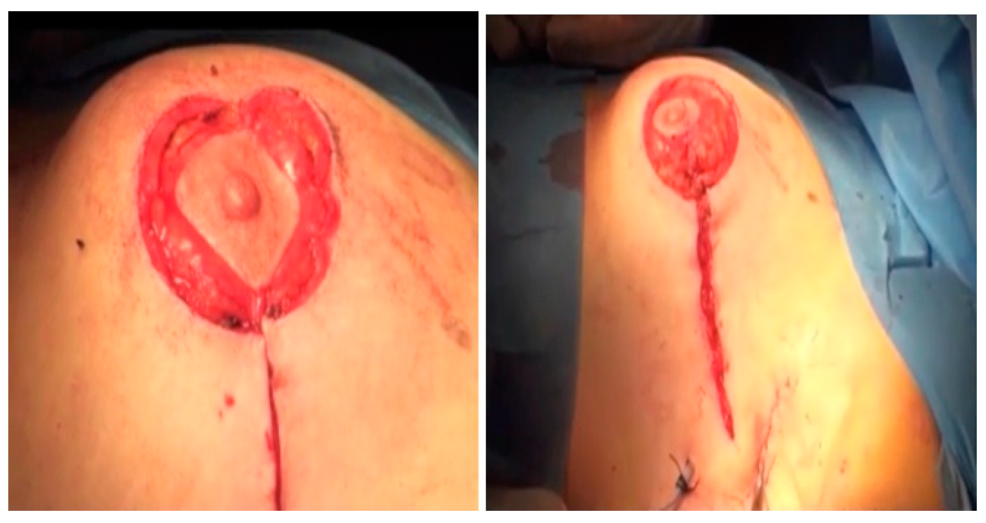 Medicina 61 00539 g003