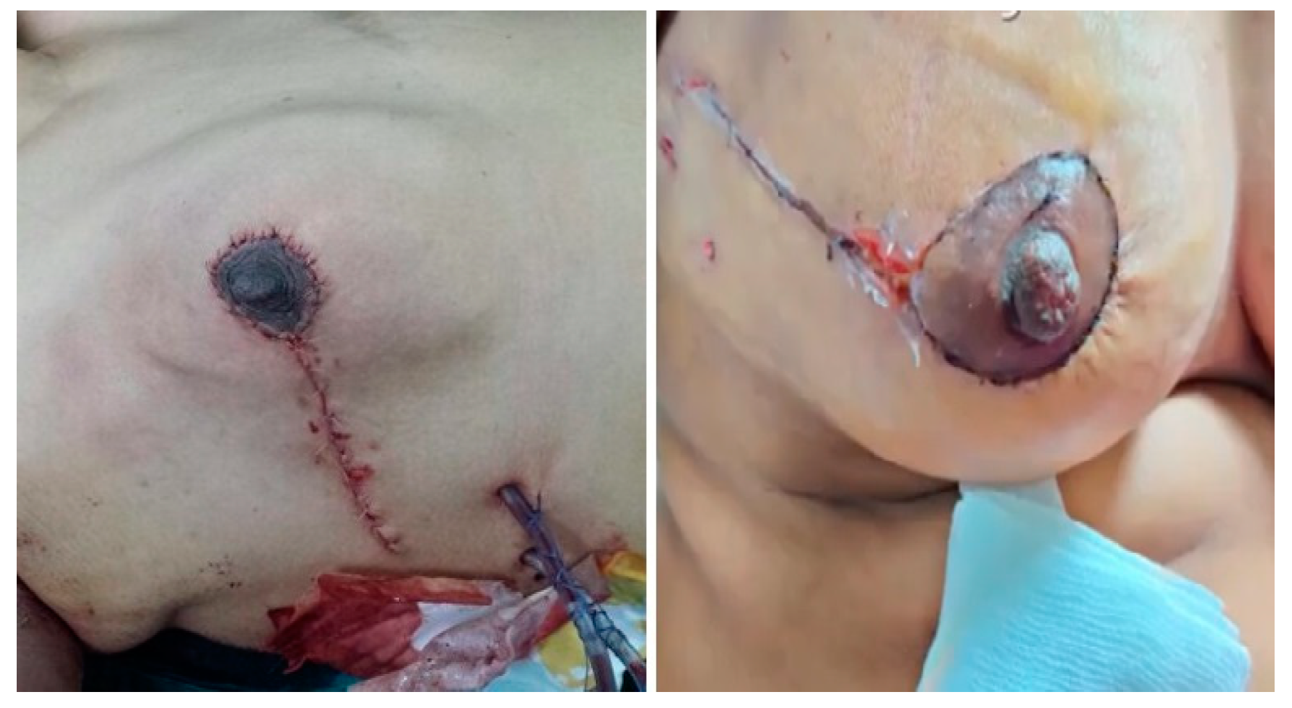 Medicina 61 00539 g004