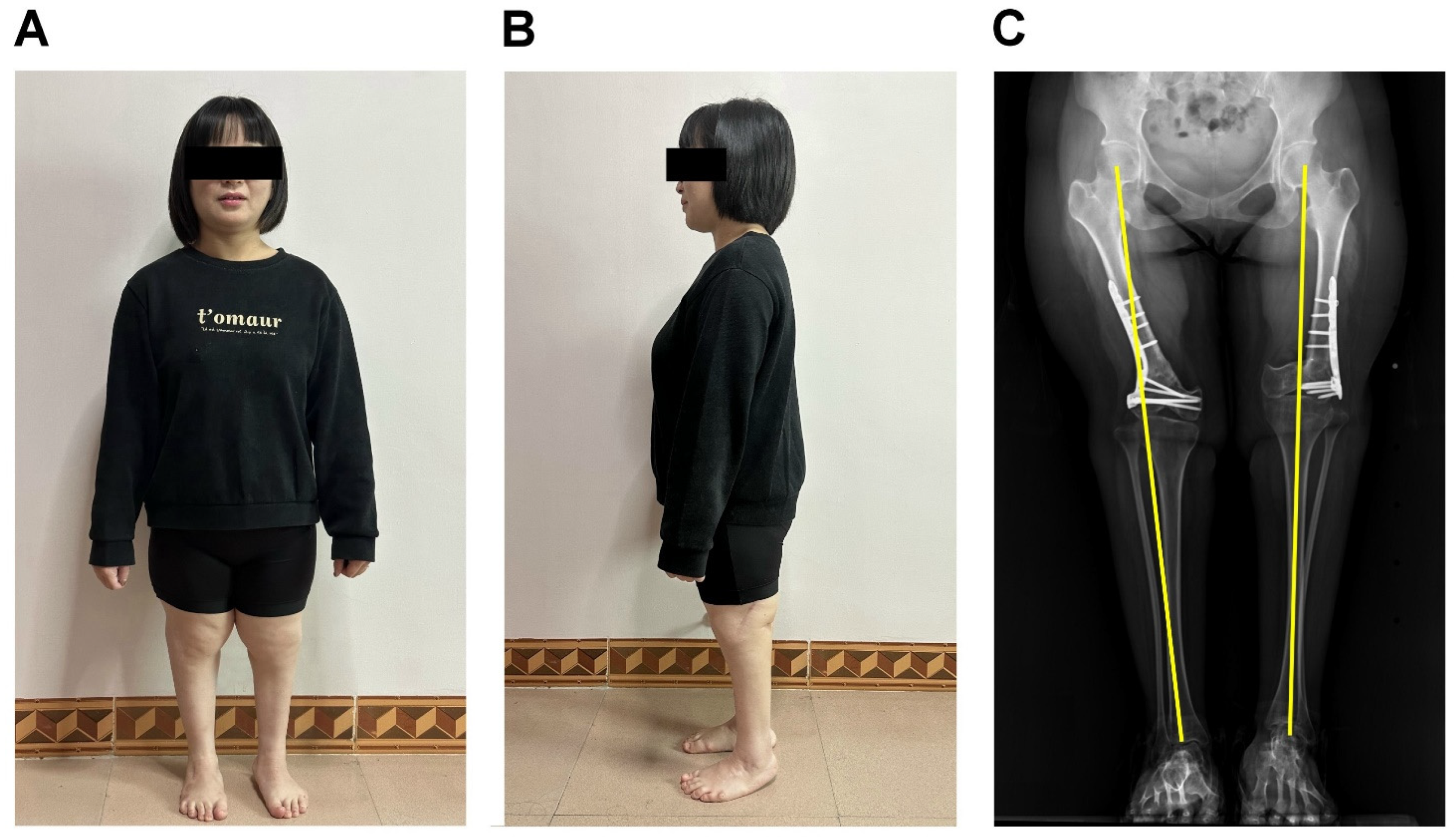 Medicina 61 00543 g005