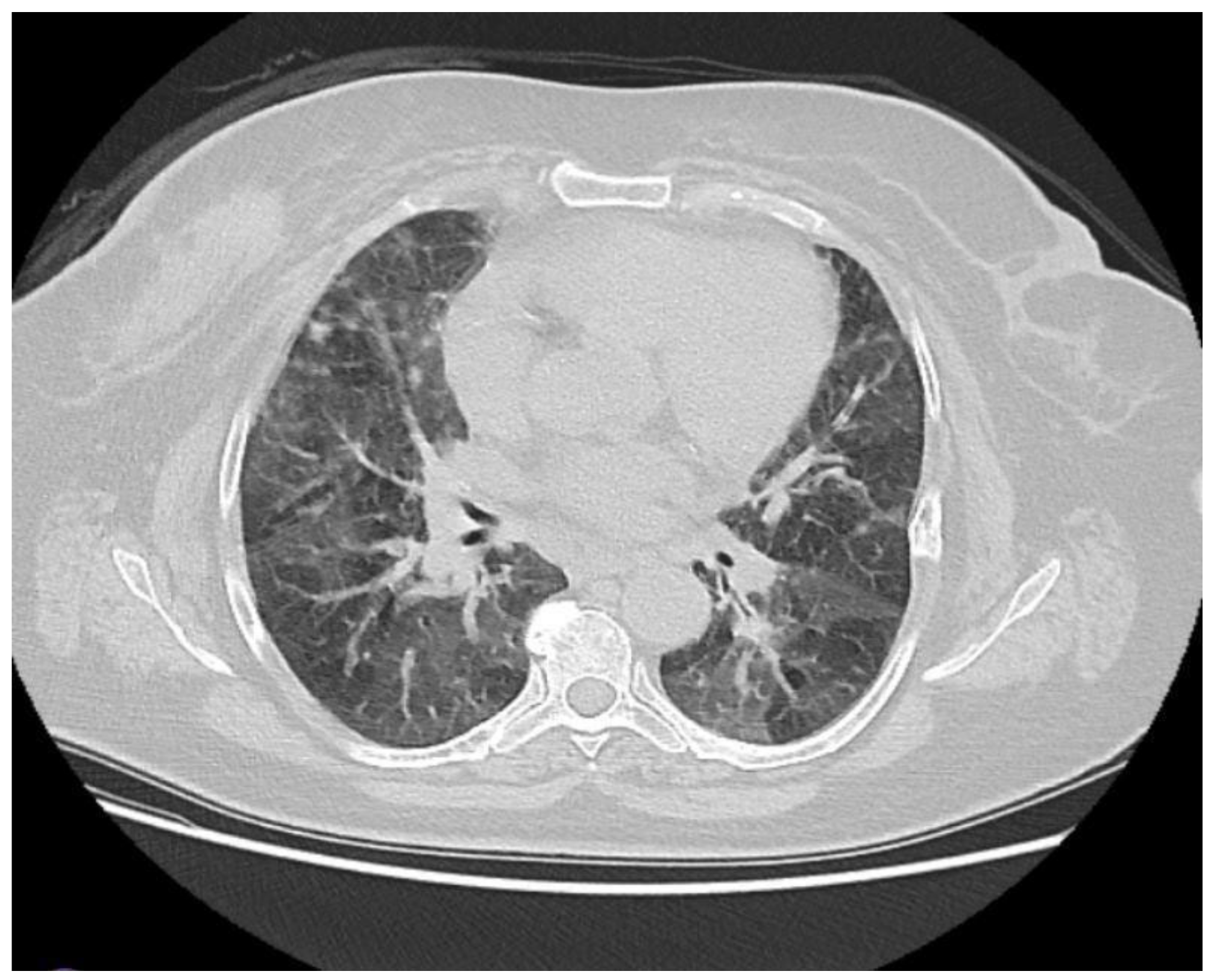 Medicina 61 00549 g003