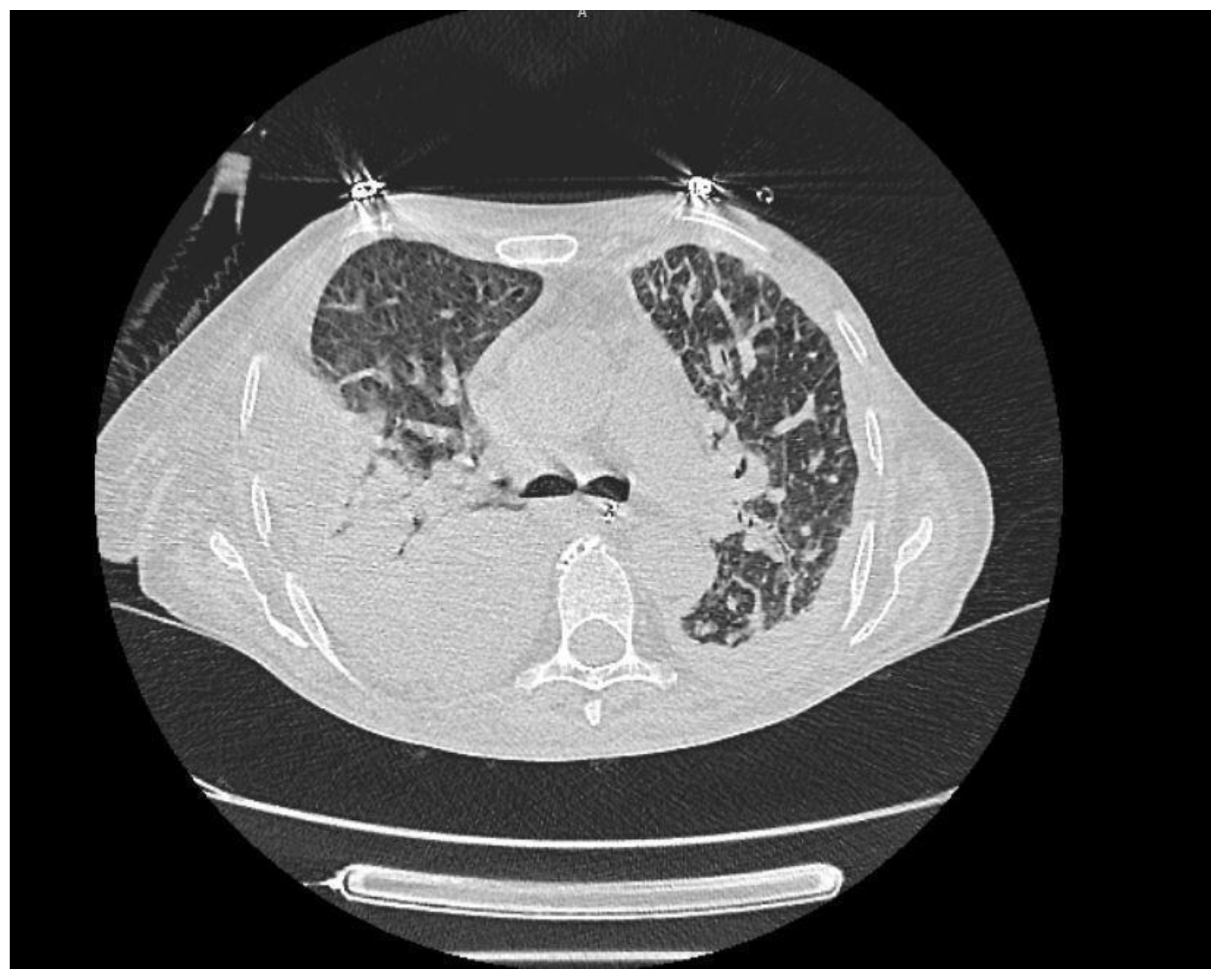 Medicina 61 00549 g004
