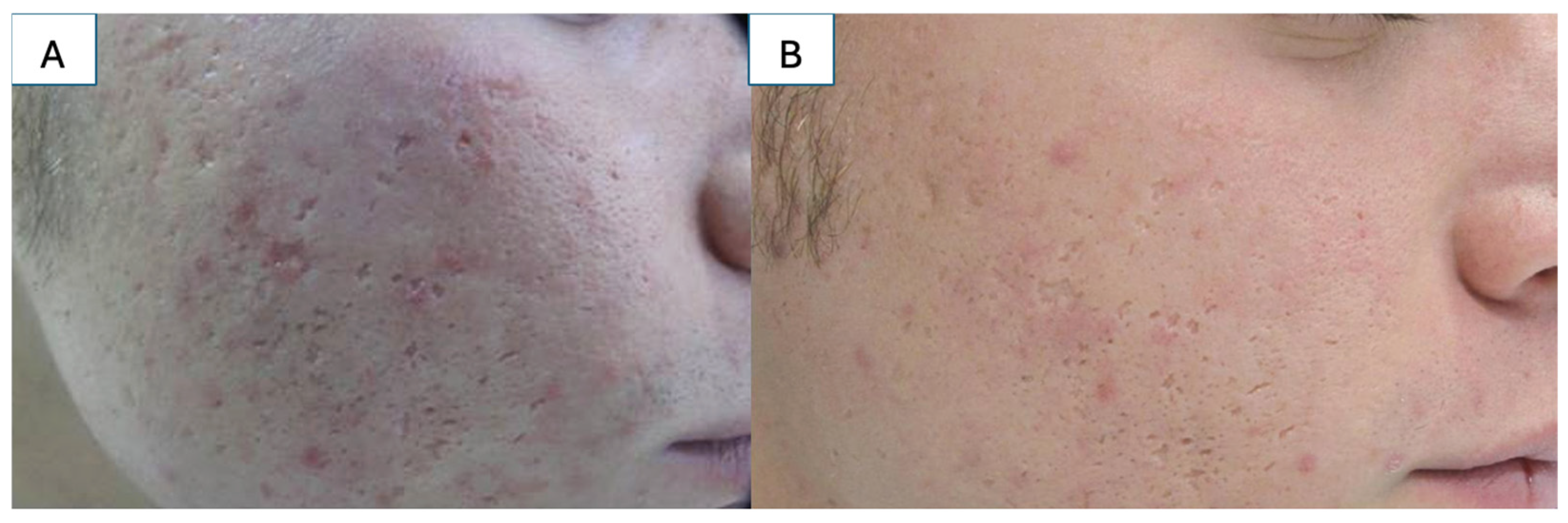 Medicina 61 00553 g004