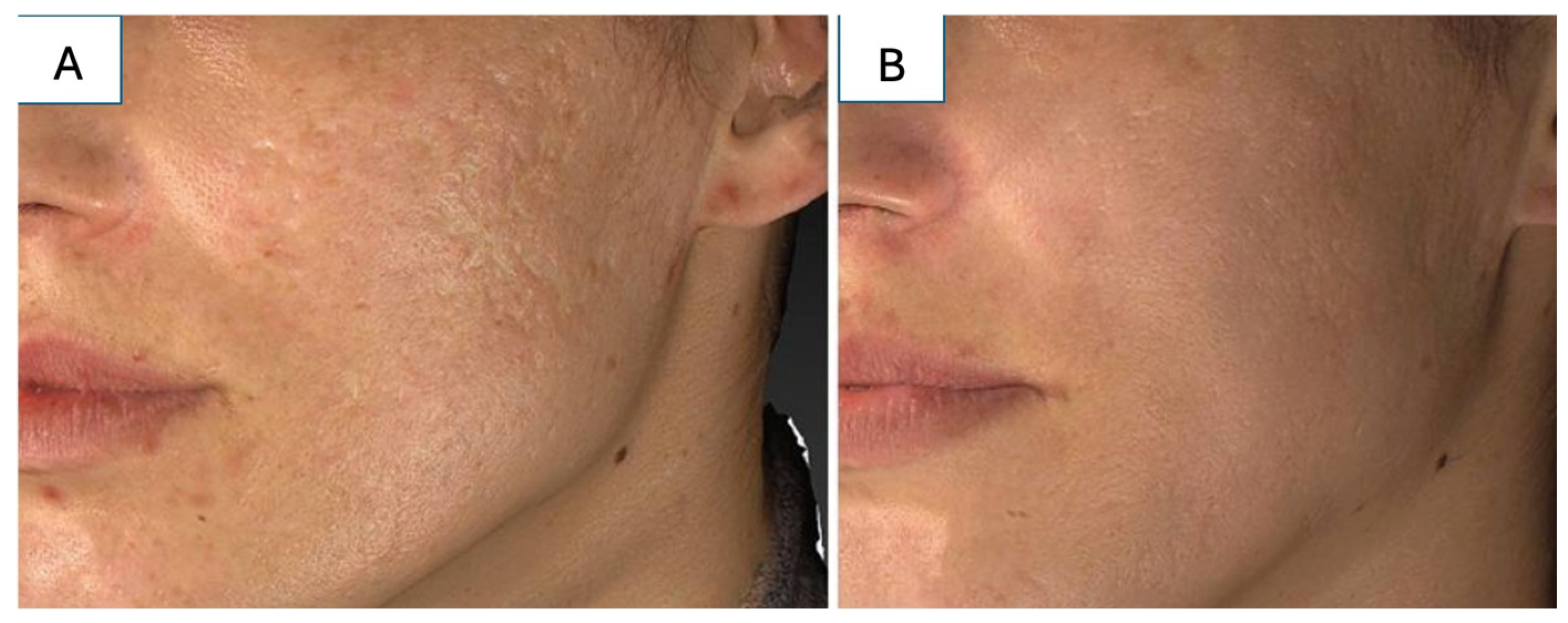 Medicina 61 00553 g005