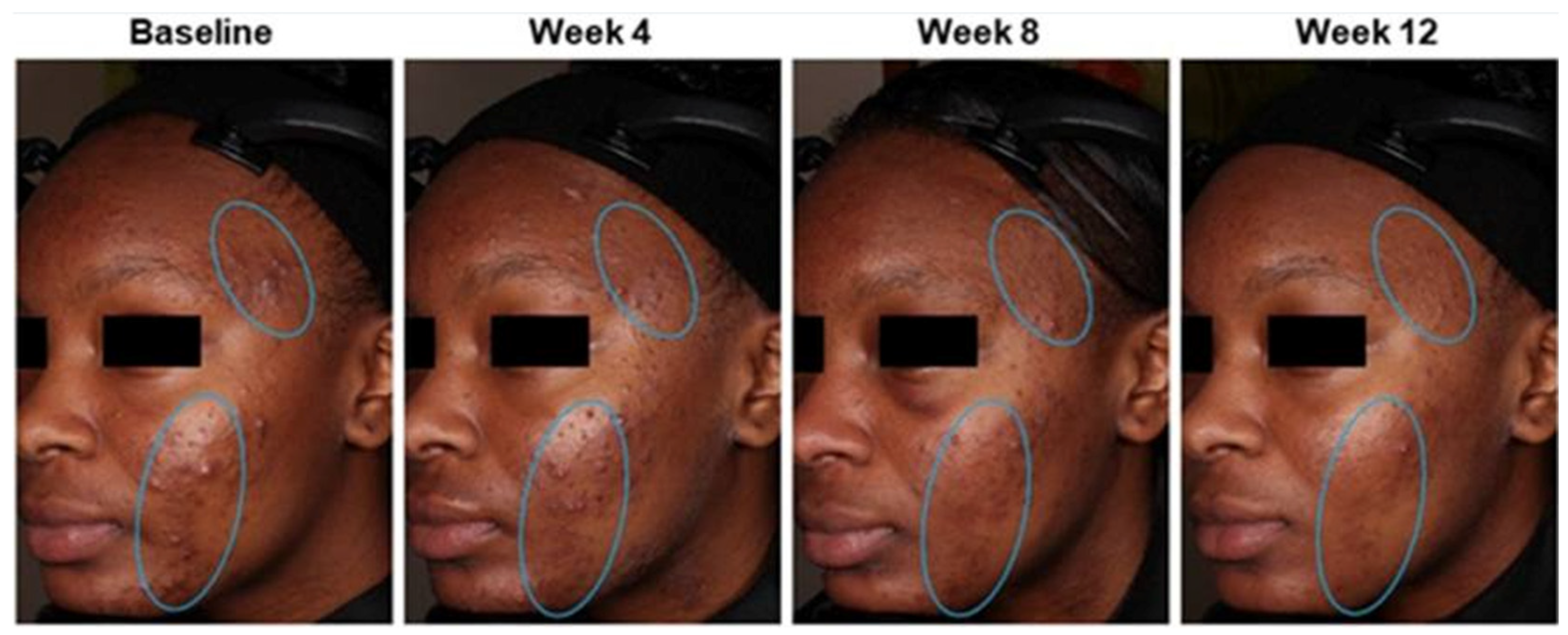 Medicina 61 00553 g006