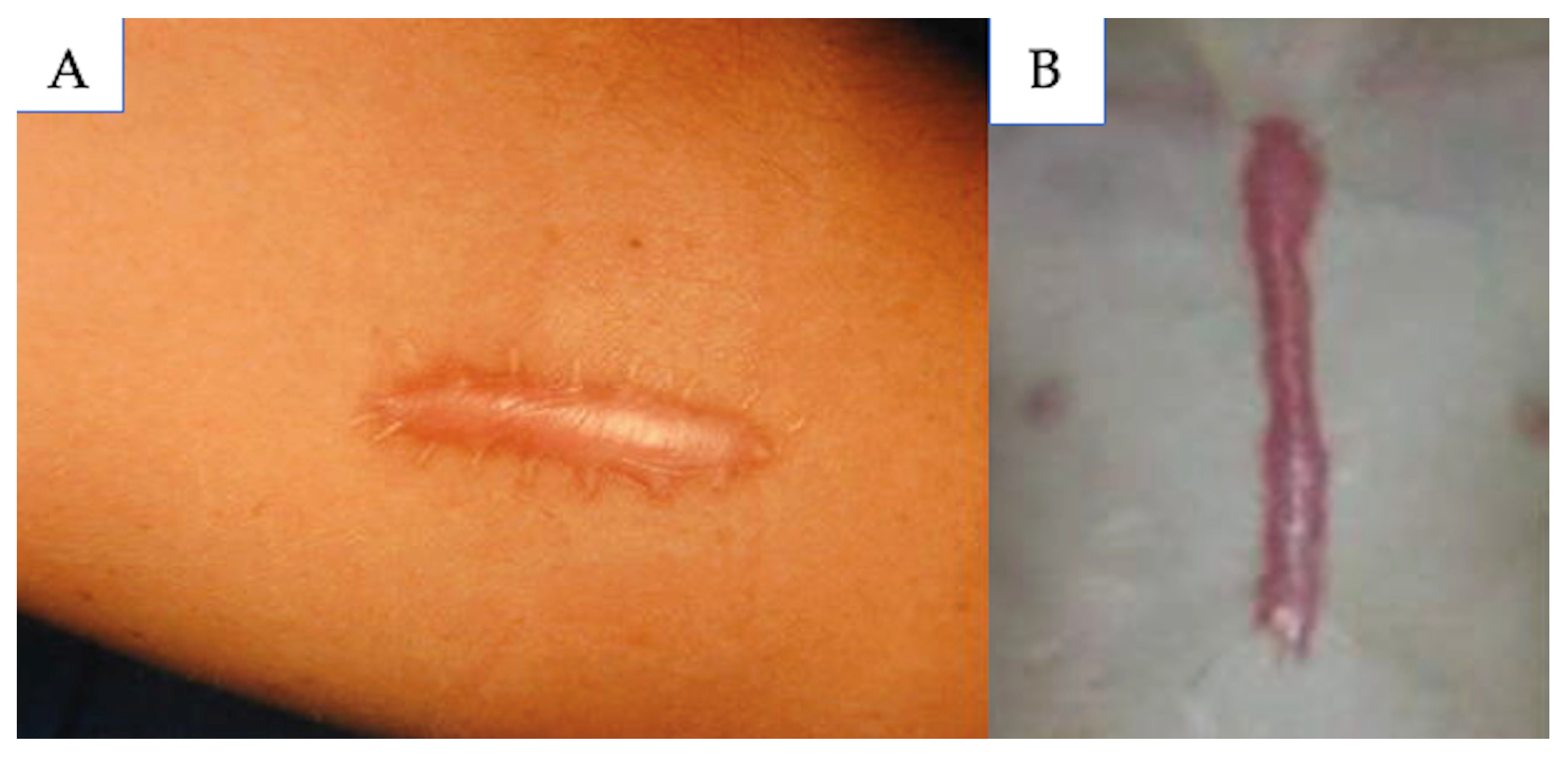 Medicina 61 00553 g007