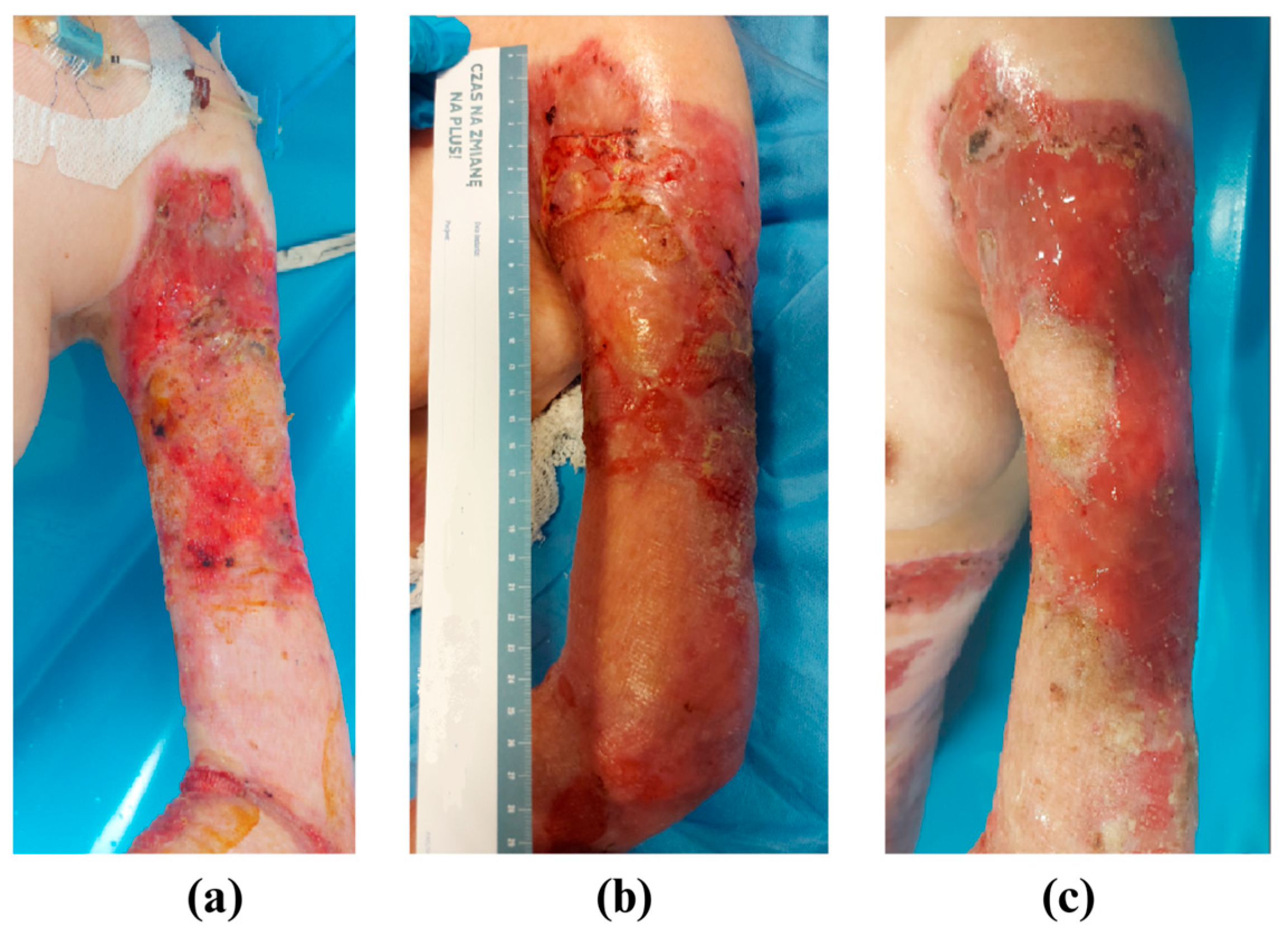 Medicina 61 00554 g001
