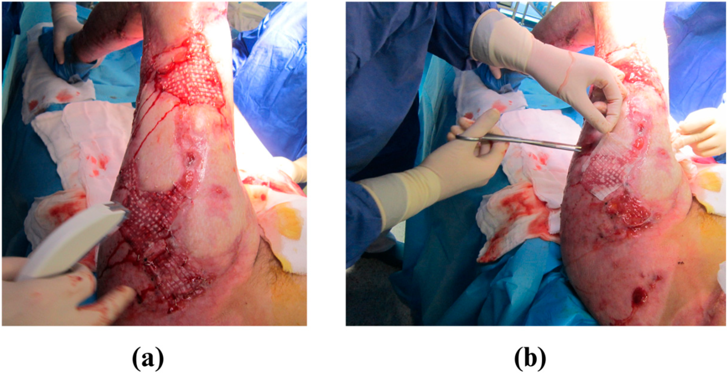 Medicina 61 00554 g002