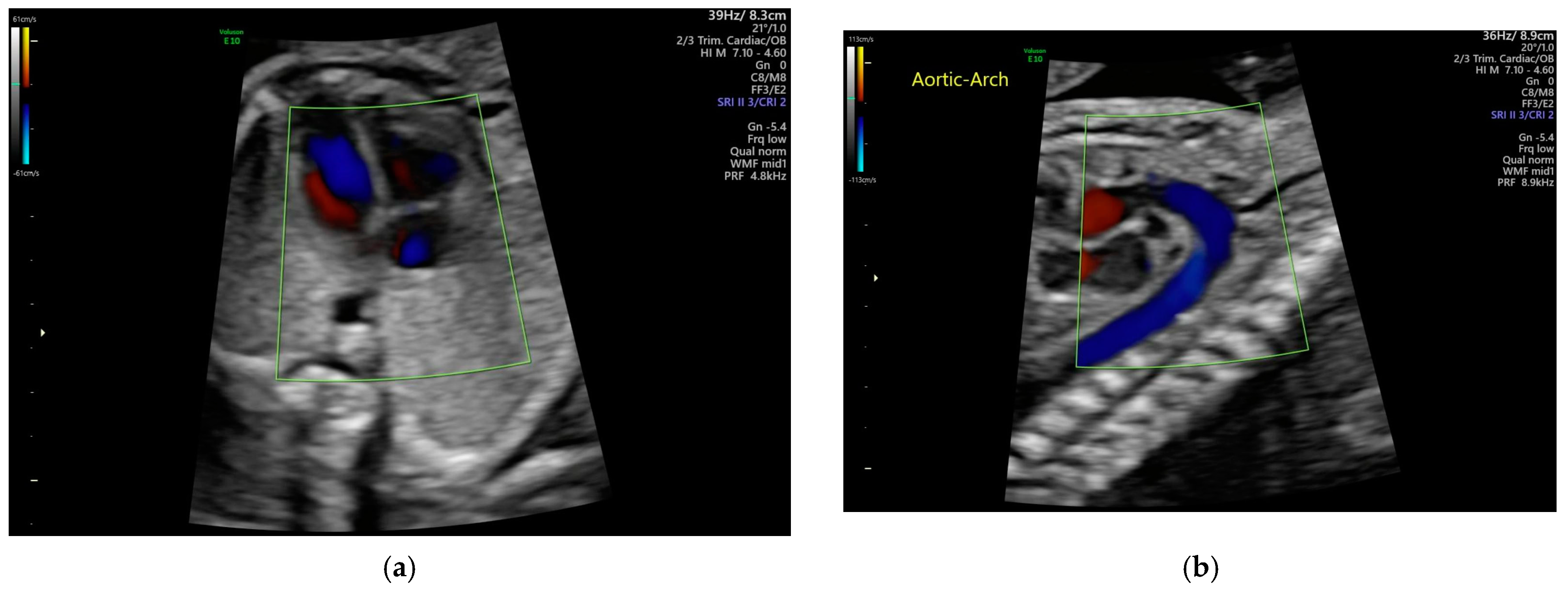 Medicina 61 00561 g002