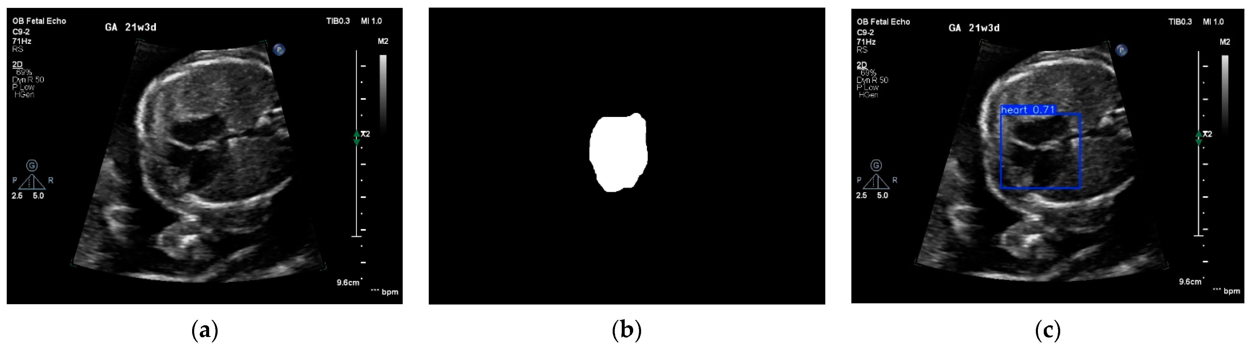 Medicina 61 00561 g003