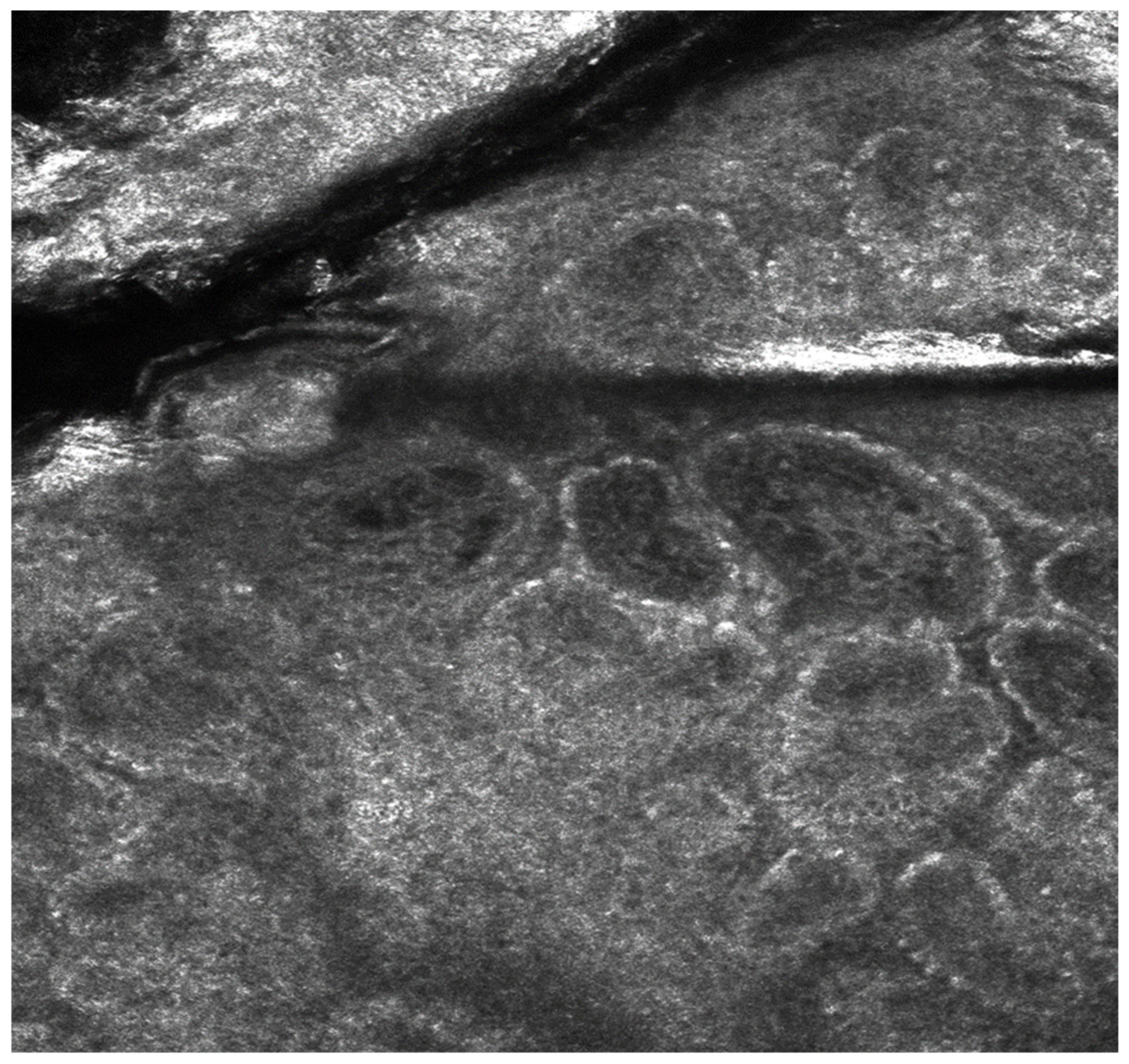 Medicina 61 00565 g004