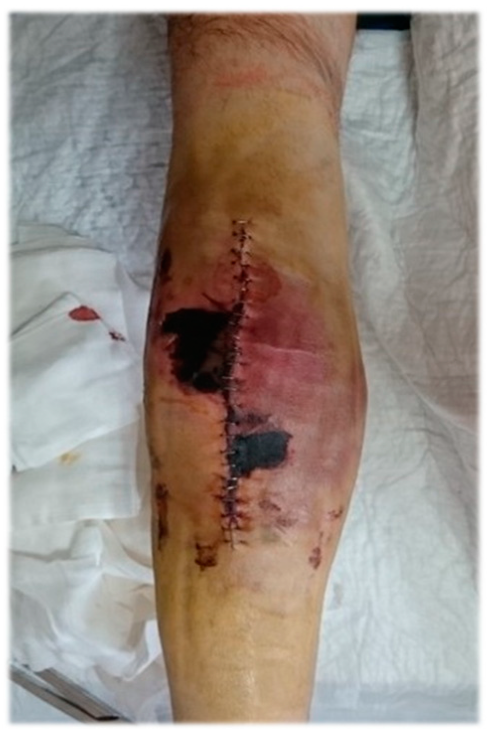 Medicina 61 00570 g003