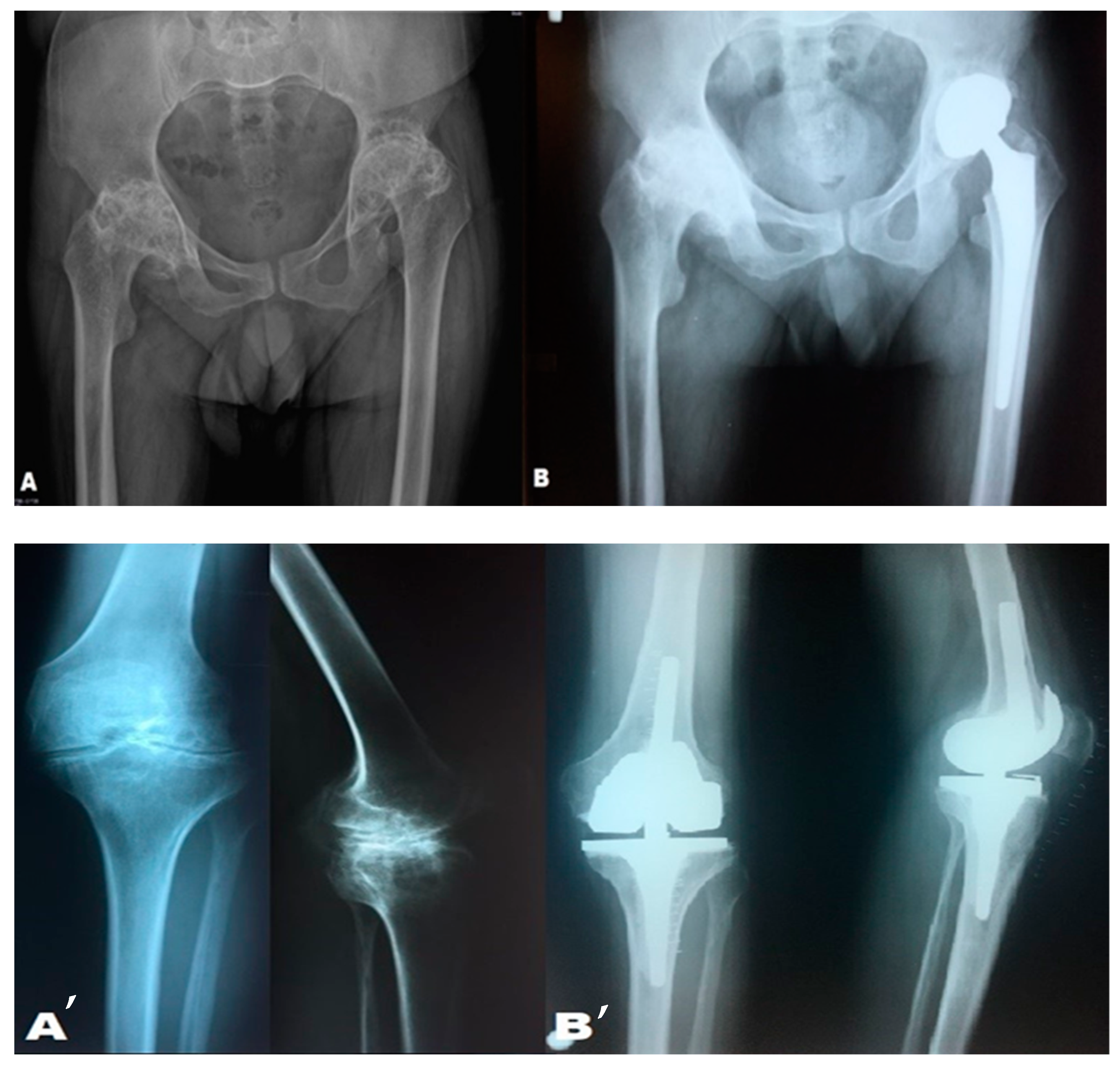 Medicina 61 00570 g004