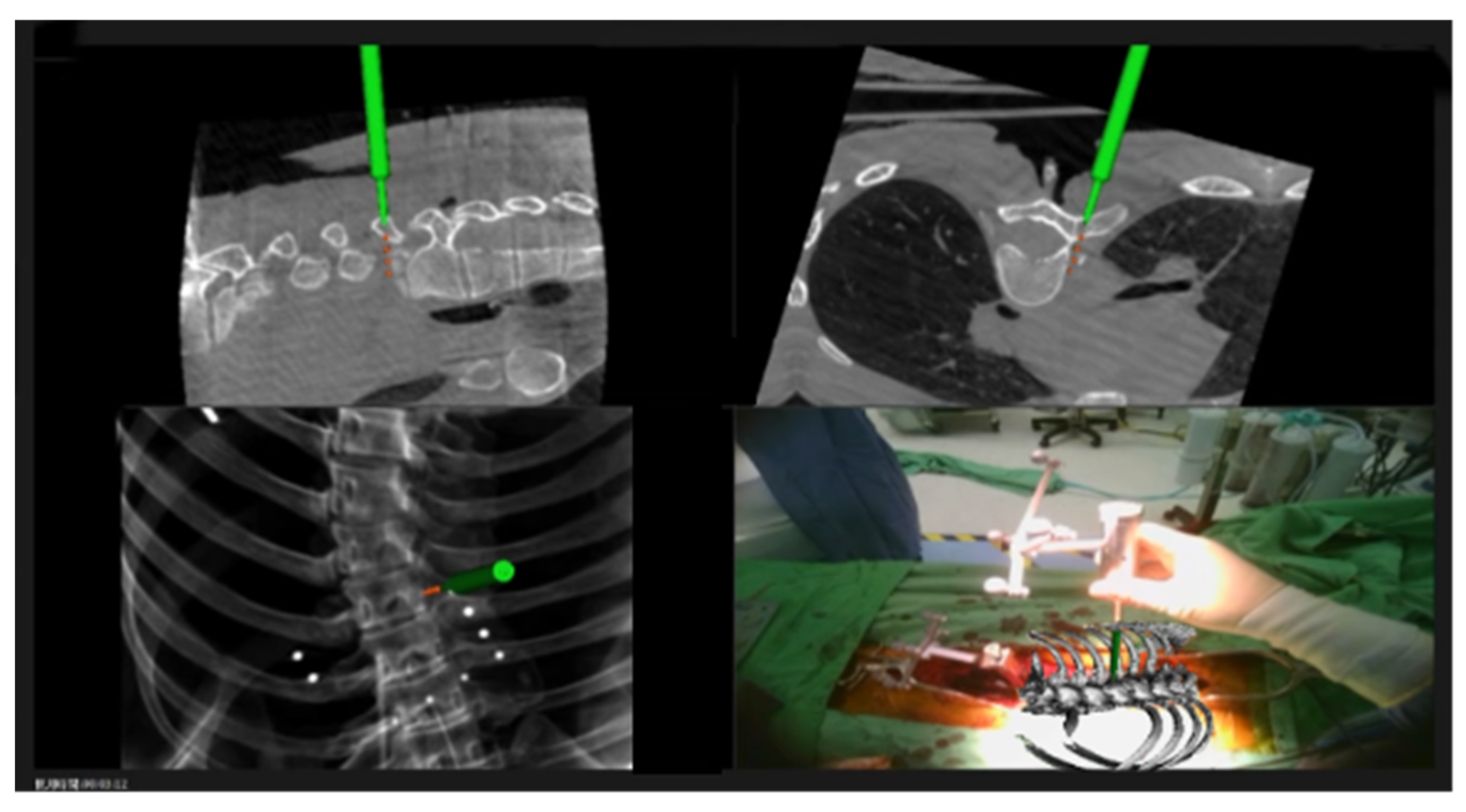 Medicina 61 00576 g001