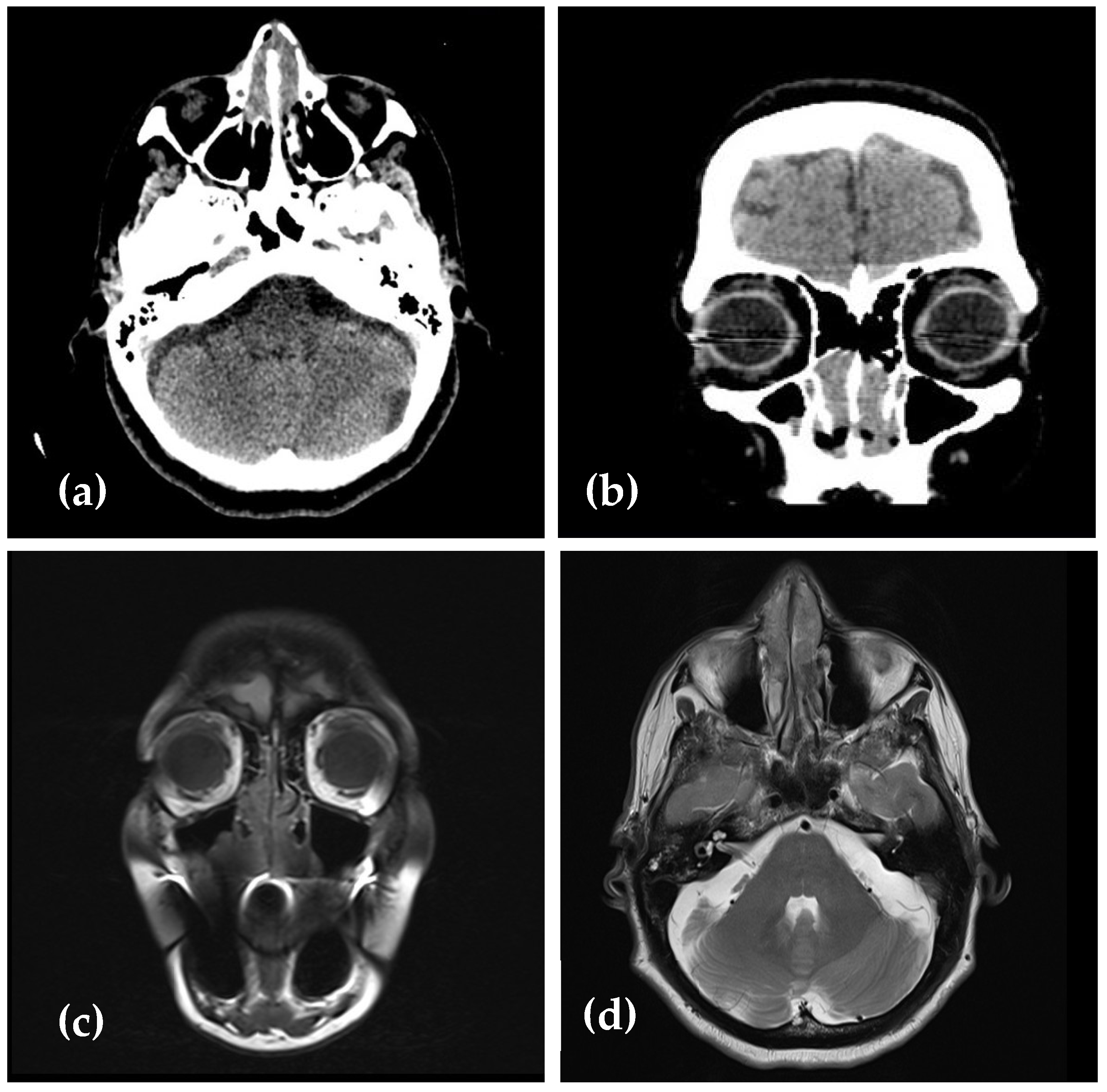 Medicina 61 00585 g002